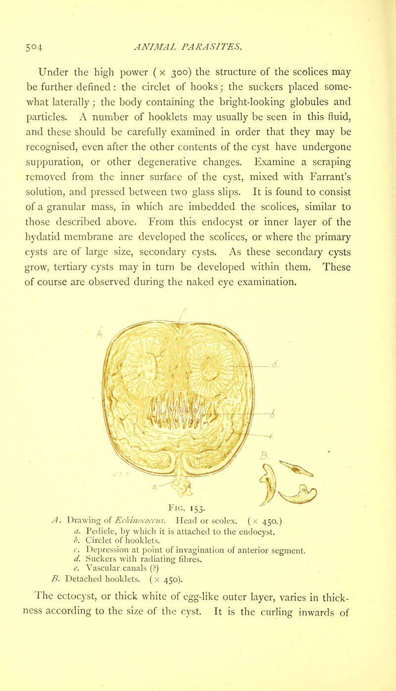 Under the high power ( x 300) the structure of the scolices may be further defined : the circlet of hooks; the suckers placed some- what laterally j the body containing the bright-looking globules and particles. A number of hooklets may usually be seen in this fluid, and these should be carefully examined in order that they may be recognised, even after the other contents of the cyst have undergone suppuration, or other degenerative changes. Examine a scraping removed from the inner surface of the cyst, mixed with Farrant's solution, and pressed between two glass slips. It is found to consist of a granular mass, in which are imbedded the scolices, similar to those described above. From this endocyst or inner layer of the hydatid membrane are developed the scolices, or where the primary cysts are of large size, secondary cysts. As these secondary cysts grow, tertiary cysts may in turn be developed within them. These of course are observed during the naked eye examination. A. Drawing of Echinococcus. Head or scolex. (x 450.) a. Pedicle, by which it is attached to the endocyst. b. Circlet of hooklets. c. Depression at point of invagination of anterior segment. d. Suckers with radiating fibres. e. Vascular canals (?) B. Detached hooklets. ( x 450). The ectocyst, or thick white of egg-like outer layer, varies in thick- ness according to the size of the cyst. It is the curling inwards of