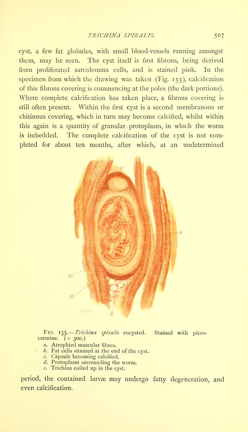 TRICHINA SPIRALIS. 5°7 cyst, a few fat globules, with small blood-vessels running amongst them, may be seen. The cyst itself is first fibrous, being derived from proliferated sarcolemma cells, and is stained pink. In the specimen from which the drawing was taken (Fig. 155), calcification of this fibrous covering is commencing at the poles (the dark portions). Where complete calcification has taken place, a fibrous covering is still often present. Within the first cyst is a second membranous or chitinous covering, which in turn may become calcified, whilst within this again is a quantity of granular - protoplasm, in which the worm is imbedded. The complete calcification of the cyst is not com- pleted for about ten months, after which, at an undetermined o. r. r. Fig. 155. — Trichina spiralis encysted. Stained with picro- carmine. ( x 300.) a. Atrophied muscular fibres. b. Fat cells situated at the end of the cyst. c. Capsule becoming calcified. d. Protoplasm surrounding the worm. e. Trichina coiled up in the cyst. period, the contained larvae may undergo fatty degeneration, and even calcification.