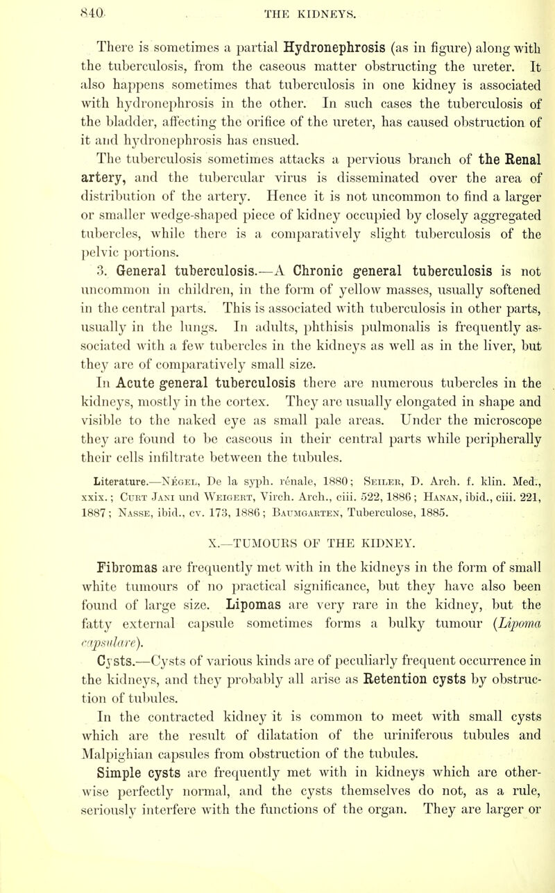 There is sometimes a partial Hydronephrosis (as in figure) along with the tuberculosis, from the caseous matter obstructing the ureter. It also happens sometimes that tuberculosis in one kidney is associated with hydronephrosis in the other. In such cases the tuberculosis of the bladder, affecting the orifice of the ureter, has caused obstruction of it and hydronephrosis has ensued. The tuberculosis sometimes attacks a pervious branch of the Renal artery, and the tubercular virus is disseminated over the area of distribution of the artery. Hence it is not uncommon to find a larger or smaller wedge-shaped piece of kidney occupied by closely aggregated tubercles, while there is a comparatively slight tuberculosis of the pelvic portions. 3. General tuberculosis.—A Chronic general tuberculosis is not uncommon in children, in the form of yellow masses, usually softened in the central parts. This is associated with tuberculosis in other parts, usually in the lungs. In adults, phthisis pulmonalis is frequently asf sociated with a few tubercles in the kidneys as well as in the liver, but they are of comparatively small size. In Acute general tuberculosis there are numerous tubercles in the kidneys, mostly in the cortex. They are usually elongated in shape and visible to the naked eye as small pale areas. Under the microscope they are found to be caseous in their central parts while peripherally their cells infiltrate between the tubules. Literature.—Negel, De la syph. renale, 1880; Seiler, D. Arch. f. klin. Med., xxix.; Curt Jani unci Weigert, Virch. Arch., ciii. 522, 1886; Hanan, ibid., ciii. 221, 1887; Nasse, ibid., cv. 173, 1886; Baumgarten, Tuberculose, 1885. X.—TUMOURS OF THE KIDNEY. Fibromas are frequently met with in the kidneys in the form of small white tumours of no practical significance, but they have also been found of large size. Lipomas are very rare in the kidney, but the fatty external capsule sometimes forms a bulky tumour (Lipoma cdpsulare). Cysts.—Cysts of various kinds are of peculiarly frequent occurrence in the kidneys, and they probably all arise as Retention cysts by obstruc- tion of tubules. In the contracted kidney it is common to meet with small cysts which are the result of dilatation of the uriniferous tubules and Malpighian capsules from obstruction of the tubules. Simple cysts are frequently met with in kidneys which are other- wise perfectly normal, and the cysts themselves do not, as a rule, seriously interfere with the functions of the organ. They are larger or
