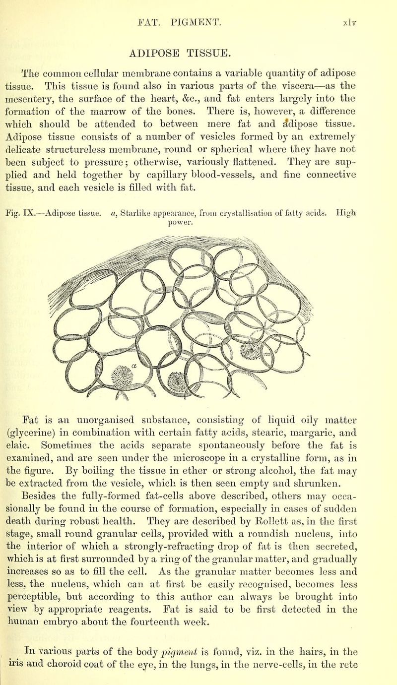 ADIPOSE TISSUE. The common cellular membrane contains a variable quantity of adipose tissue. This tissue is found also in various parts of the viscera—as the mesentery, the surface of the heart, &c, and fat enters largely into the formation of the marrow of the bones. There is, however, a difference which should be attended to between mere fat and adipose tissue. Adipose tissue consists of a number of vesicles formed by an extremely delicate structureless membrane, round or spherical where they have not been subject to pressure; otherwise, variously flattened. They are sup- plied and held together by capillary blood-vessels, and fine connective tissue, and each vesicle is filled with fat. Fig, IX.—Adipose tissue, a. Starlike appearance, from crystallisation of fatty acids. High power. Fat is an unorganised substance, consisting of liquid oily matter (glycerine) in combination with certain fatty acids, stearic, margaric, and elaic. Sometimes the acids separate spontaneously before the fat is examined, and are seen under the microscope in a crystalline form, as in the figure. By boiling the tissue in ether or strong alcohol, the fat may be extracted from the vesicle, which is then seen empty and shrunken. Besides the fully-formed fat-cells above described, others may occa- sionally be found in the course of formation, especially in cases of sudden death during robust health. They are described by RolJett as, in the first stage, small round granular cells, provided with a roundish nucleus, into the interior of which a strongly-refracting drop of fat is then secreted, which is at first surrounded by a ring of the granular matter, and gradually increases so as to fill the cell. As the granular matter becomes less and less, the nucleus, which can at first be easily recognised, becomes less perceptible, but according to this author can always be brought into view by appropriate reagents. Fat is said to be first detected in the human embryo about the fourteenth week. In various parts of the body pigment is found, viz. in the hairs, in the iris and choroid coat of the eye, in the lungs, in the nerve-cells, in the rete