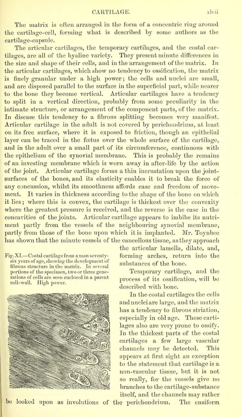 Tlie matrix is often arranged in the form of a concentric ring around tlie cartilage-cell, forming what is described by some authors as the cartilage-capsuie. The articular cartilages, the temporary cartilages, and the costal car- tilages, are all of the hyaline variety. They present minute differences in the size and shape of their cells, and in the arrangement of the matrix. In the articular cartilages, which show no tendency to ossification, the matrix is finely granular under a high power; the cells and nuclei are small, and are disposed parallel to the surface in the superficial part, while nearer to the bone they become vertical. Articular cartilages have a tendency to split in a vertical direction, probably from some peculiarity in the intimate structure, or arrangement of the component parts, of the matrix. In disease this tendency to a fibrous splitting becomes very manifest. Articular cartilage in the adult is not covered by perichondrium, at least on its free surface, where it is exposed to friction, though an epithelial layer can be traced in the foetus over the whole surface of the cartilage, and in the adult over a small part of its circumference, continuous with the epithelium of the synovial membrane. This is probably the remains of an investing membrane which is worn away in after-life by the action of the joint. Articular cartilage forms a thin incrustation upon the joint- surfaces of the bones, and its elasticity enables it to break the force of any concussion, whilst its smoothness affords ease and freedom of move- ment. It varies in thickness according to the shape of the bone on which it lies; where this is convex, the cartilage is thickest over the convexity where the greatest pressure is received, and the reverse is the case in the concavities of the joints. Articular cartilage appears to imbibe its nutri- ment partly from the vessels of the neighbouring synovial membrane, partly from those of the bone upon which it is implanted. Mr. Toynbee has shown that the minute vessels of the cancellous tissue, as they approach the articular lamella, dilate, and, forming arches, return into the substances of the bone. Temporary cartilage, and the process of its ossification, will be described with bone. In the costal cartilages the cells and nuclei are large, and the matrix has a tendency to fibrous striation, especially in old age. These carti- lages also are very prone to ossify. In the thickest parts of the costal cartilages a few large vascular channels may be detected. This appears at first sight an exception to the statement that cartilage is a non-vascular tissue, but it is not so really, for the vessels give no branches to the cartilage-substance itself, and the channels may rather ked upon as involutions of the perichondrium. The ensiform Fig. XI.—Costal cartilage from a man seventy- six years of age, showing the development of fibrous structure in the matrix. In several portions of the specimen, two or three gene- rations of cells are seen enclosed in a parent cell-wall. High power.