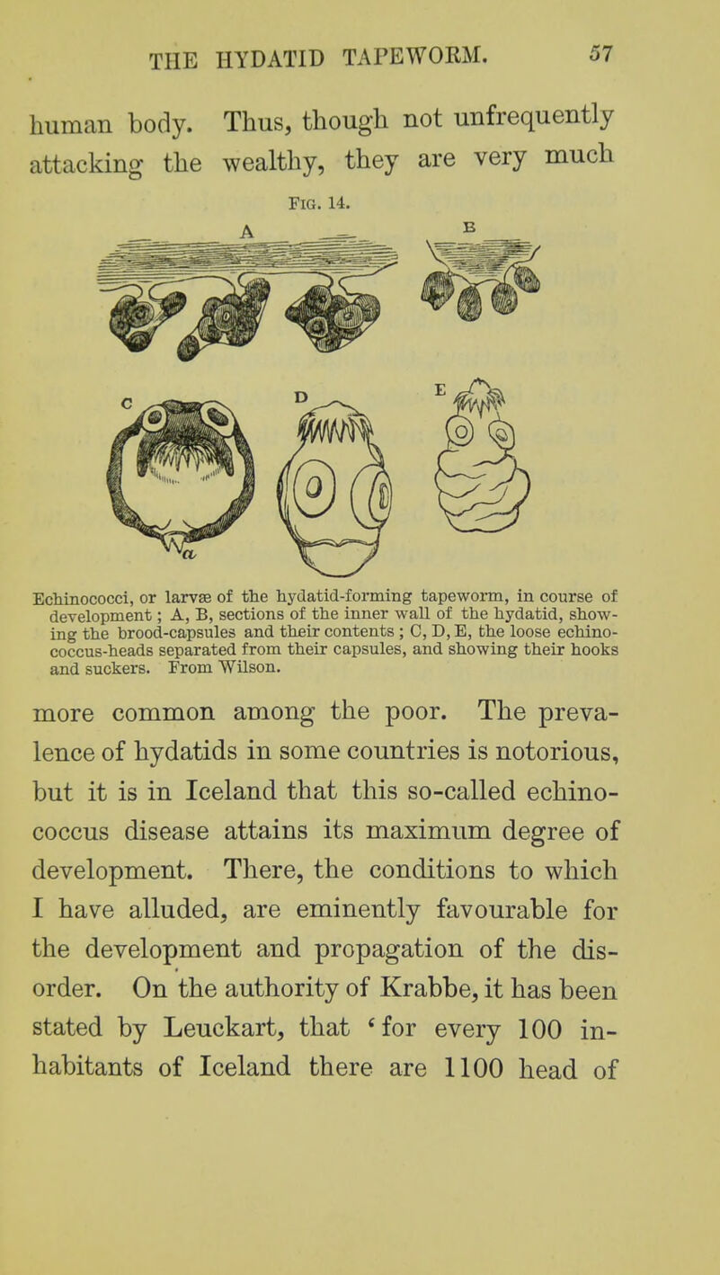 human body. Thus, though not unfrequently attacking the wealthy, they are very much Fig. 14. Echinococci, or larvae of the hydatid-forming tapeworm, in course of development; A, B, sections of the inner wall of the hydatid, show- ing the brood-capsules and their contents ; C, D,E, the loose echino- coccus-heads separated from their capsules, and showing their hooks and suckers. From Wilson. more common among the poor. The preva- lence of hydatids in some countries is notorious, but it is in Iceland that this so-called echino- coccus disease attains its maximum degree of development. There, the conditions to which I have alluded, are eminently favourable for the development and propagation of the dis- order. On the authority of Krabbe, it has been stated by Leuckart, that 'for every 100 in- habitants of Iceland there are 1100 head of