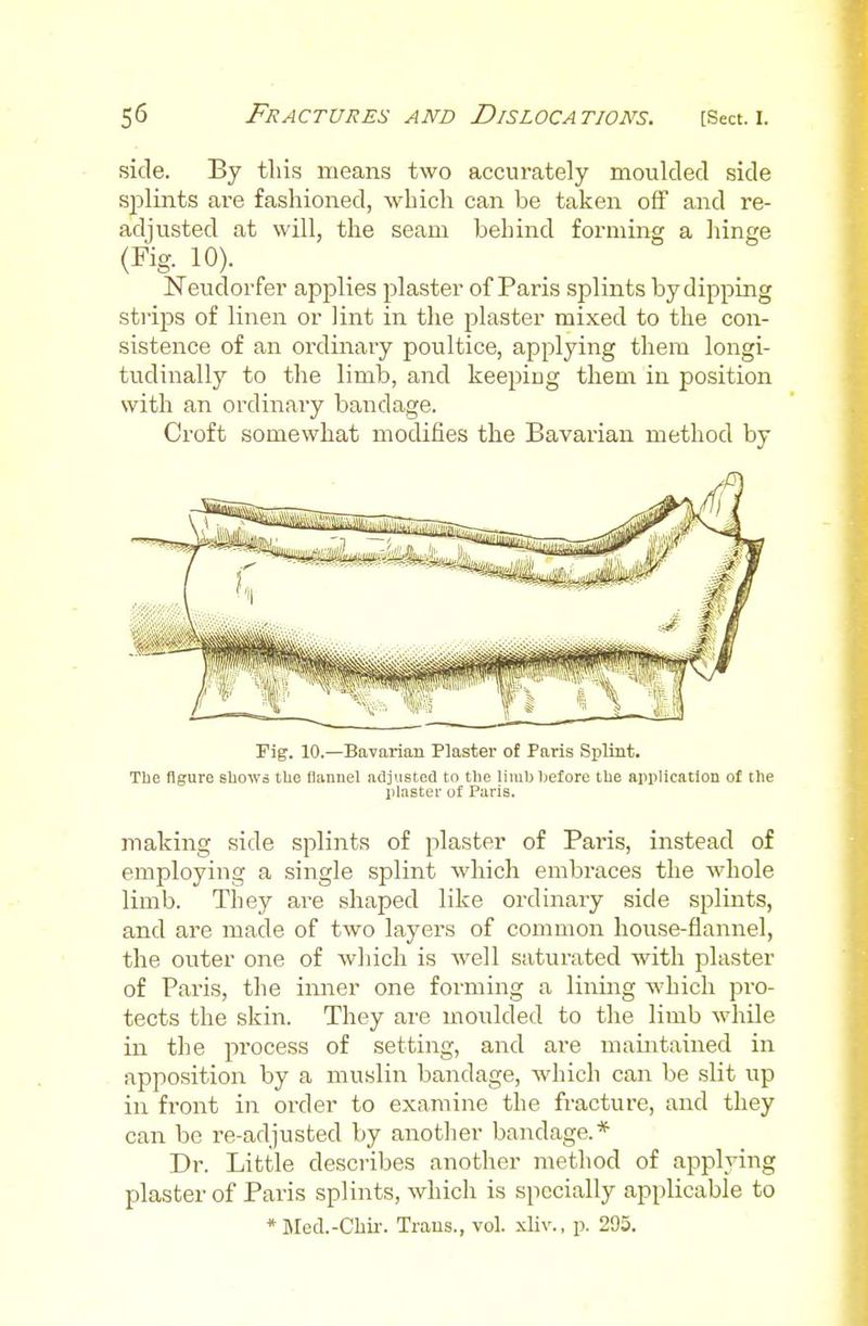side. By this means two accurately moulded side sjDliiits are fashioned, which can be taken off and re- adjusted at will, the seam behind forming a liinge (Fig. 10). Neudorfer applies plaster of Paris splints by dipping strips of linen or lint in the plaster mixed to the con- sistence of an ordinary poultice, applying them longi- tudinally to the limb, and keeping them in position with an ordinary bandage. Croft somewhat modifies the Bavarian method by Fig. 10.—BaTarian Plaster of Paris Splint. The figure shows tUe flannel adjusted to the limb before the application of the plaster of Paris. making side splints of plaster of Paris, instead of employing a single splint which embraces the whole limb. They are shaped like ordinaiy side splints, and are made of two layers of common house-flannel, the outer one of which is well saturated with plaster of Paris, the inner one foi-ming a lining which pro- tects the skin. They ai'e moulded to the limb while in tlie process of setting, and are maintained in apposition by a muslin bandage, which can be slit up in front in order to examine the fracture, and they can be re-adjusted by anotlier bandage.* Dr. Little describes another method of applying plaster of Paris splints, which is specially applicable to * Med.-Chii-. Trans., vol. xliv., p. 295.