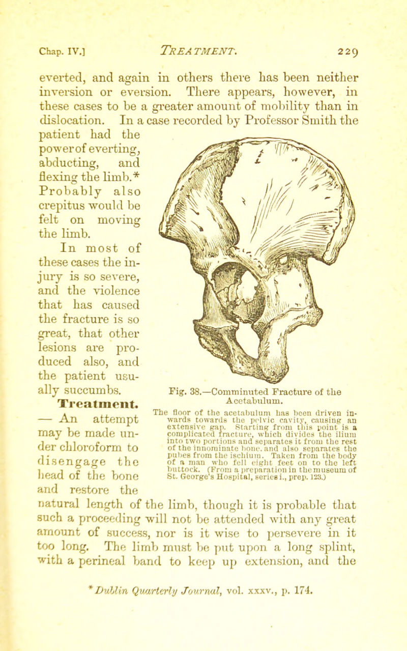 everted, and again in others thei'e has been neither inversion or eversion. There appears, however, in these cases to be a greater amount of molality than in dislocation. In a case recorded by Professor Smith the patient had the power of everting, abducting, and flexing the limb.* Probably also crepitus would be felt on moving the limb. In most of these cases the in- jury is so severe, and the violence that has caused the fracture is so great, that other lesions are pro- duced also, and the patient usu- ally succumbs. Treatment. — An attempt may be made un- der chloroform to disengage the liead of the bone and restore the natural length of the limb, though it is probable that such a proceeding will not be attended with any great amount of success, nor is it wise to persevere in it too long. The limb must be put upon a long splint, with a perineal band to keep up extension, and the Fig. 38.—Comminiitecl Fracture of the Acetabulum. The floor of the acetabulum has hcen rtriven in- wards towards the pelvic cavity, causing an extensive gap. Startinj? from this point is a complicated fracture, which divides the ilium into two portions and separates it from the rest of the innominate hone, and also separates the puhea from the ischium. Taken from the body o£ a man who fell eight feet on to the left buttock. (From a j)reparation in the museum of St. George s Hospital, series i., prop. 123.J * Dublin Qvxi/rterhj Journal, vol. xxxv., p. 174.