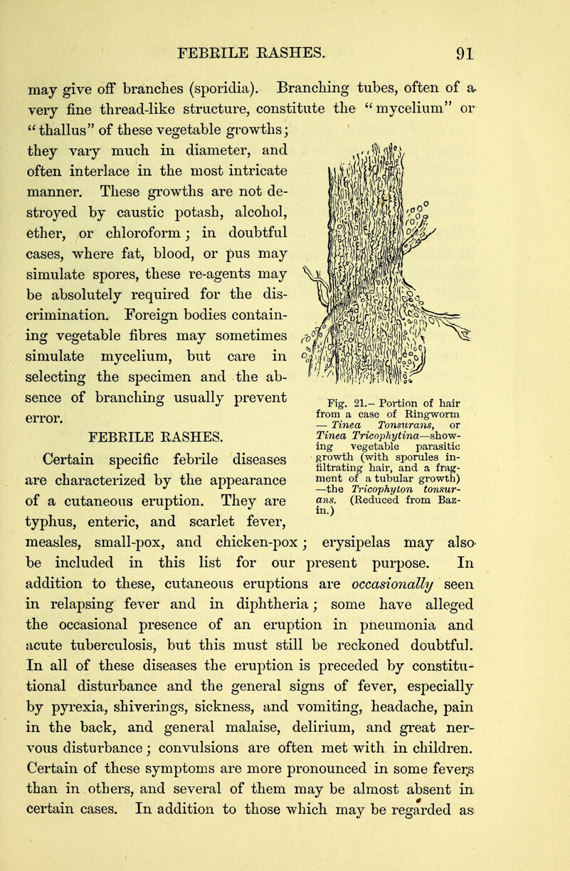 may give off branches (sporidia). Branching tubes, often of a- very fine thread-like structure, constitute the mycelium or  thallus of these vegetable growths; they vary much in diameter, and often interlace in the most intricate manner. These growths are not de- stroyed by caustic potash, alcohol, ether, or chloroform; in doubtful cases, where fat, blood, or pus may simulate spores, these re-agents may be absolutely required for the dis- crimination. Foreign bodies contain- ing vegetable fibres may sometimes simulate mycelium, but care in selecting the specimen and the ab- sence of branching usually prevent error. FEBRILE RASHES. Certain specific febrile diseases are characterized by the appearance of a cutaneous eruption. They are typhus, enteric, and scarlet fever, measles, small-pox, and chicken-pox; erysipelas may also be included in this list for our present purpose. In addition to these, cutaneous eruptions are occasionally seen in relapsing fever and in diphtheria; some have alleged the occasional presence of an eruption in pneumonia and acute tuberculosis, but this must still be reckoned doubtful. In all of these diseases the eruption is preceded by constitu- tional disturbance and the general signs of fever, especially by pyrexia, shiverings, sickness, and vomiting, headache, pain in the back, and general malaise, delirium, and great ner- vous disturbance; convulsions are often met with in children. Certain of these symptoms are more pronounced in some fever.s than in .others, and several of them may be almost absent in certain cases. In addition to those which may be regarded as Fig. 21.— Portion of hair from a case of Ringworm — Tinea Tonsurans, or Tinea Tricophytina—show- ing vegetable parasitic growth (with sporules in- filtrating hair, and a frag- ment of a tubular growth) —the Tricophyton tonsur- ans. (Reduced from Baz- in.)