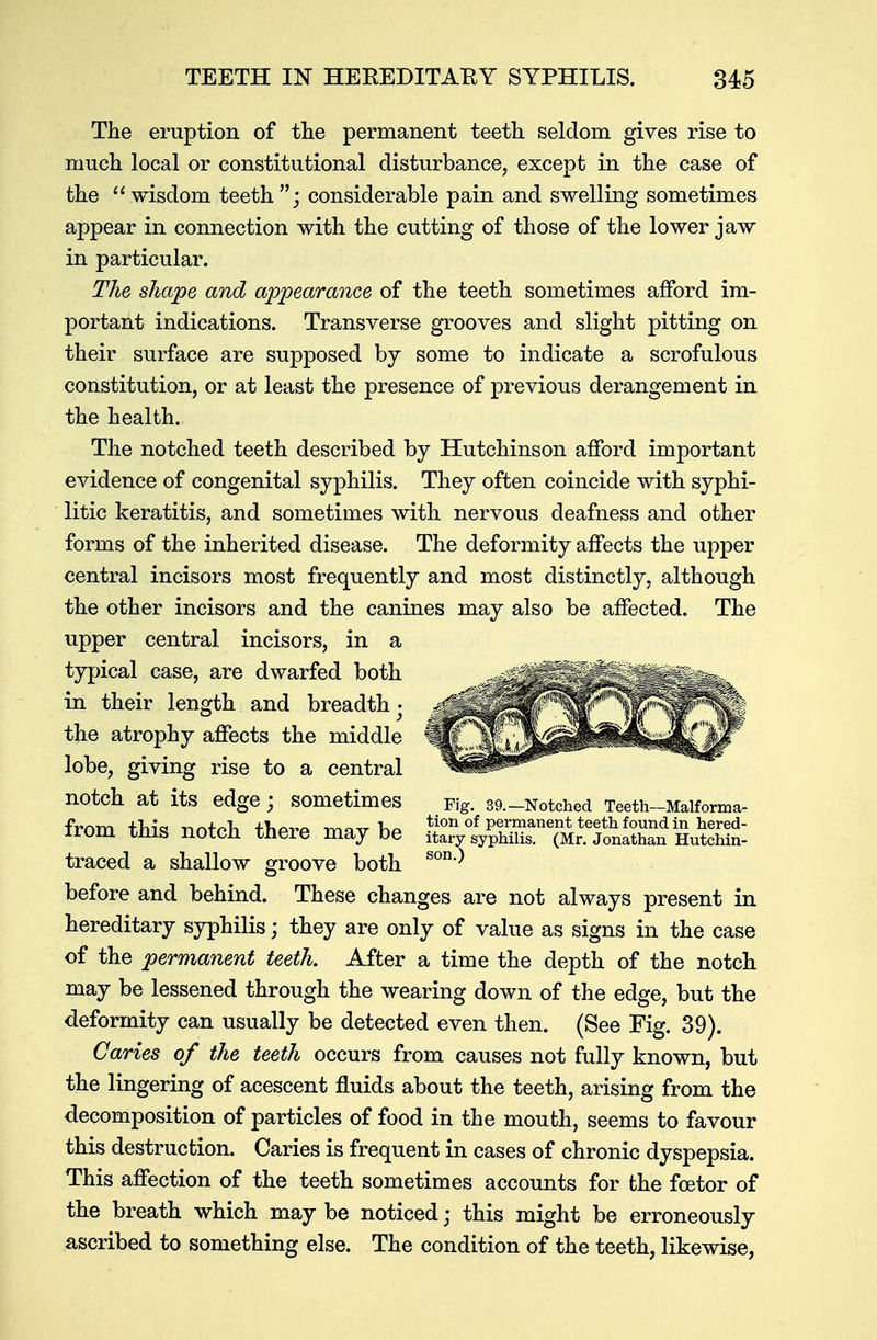 The eruption of the permanent teeth seldom gives rise to much local or constitutional disturbance, except in the case of the wisdom teeth; considerable pain and swelling sometimes appear in connection with the cutting of those of the lower jaw in particular. The shape and appearance of the teeth sometimes afford im- portant indications. Transverse grooves and slight pitting on their surface are supposed by some to indicate a scrofulous constitution, or at least the presence of previous derangement in the health. The notched teeth described by Hutchinson afford important evidence of congenital syphilis. They often coincide with syphi- litic keratitis, and sometimes with nervous deafness and other forms of the inherited disease. The deformity affects the upper central incisors most frequently and most distinctly, although the other incisors and the canines may also be affected. The upper central incisors, in a typical case, are dwarfed both in their length and breadth- the atrophy affects the middle lobe, giving rise to a central notch at its edge ; Sometimes Fig. 39.-Notched Teeth-Malforma- from thk rmtrh tWp mnv V>p tion of permanent teeth found in hered- lrom LUIS llOtcn tnere may De itary syphilis. (Mr. Jonathan Hutchin- traced a shallow groove both son ) before and behind. These changes are not always present in hereditary syphilis; they are only of value as signs in the case of the permanent teeth. After a time the depth of the notch may be lessened through the wearing down of the edge, but the deformity can usually be detected even then. (See Fig. 39). Caries of the teeth occurs from causes not fully known, but the lingering of acescent fluids about the teeth, arising from the decomposition of particles of food in the mouth, seems to favour this destruction. Caries is frequent in cases of chronic dyspepsia. This affection of the teeth sometimes accounts for the fcetor of the breath which may be noticed; this might be erroneously ascribed to something else. The condition of the teeth, likewise,