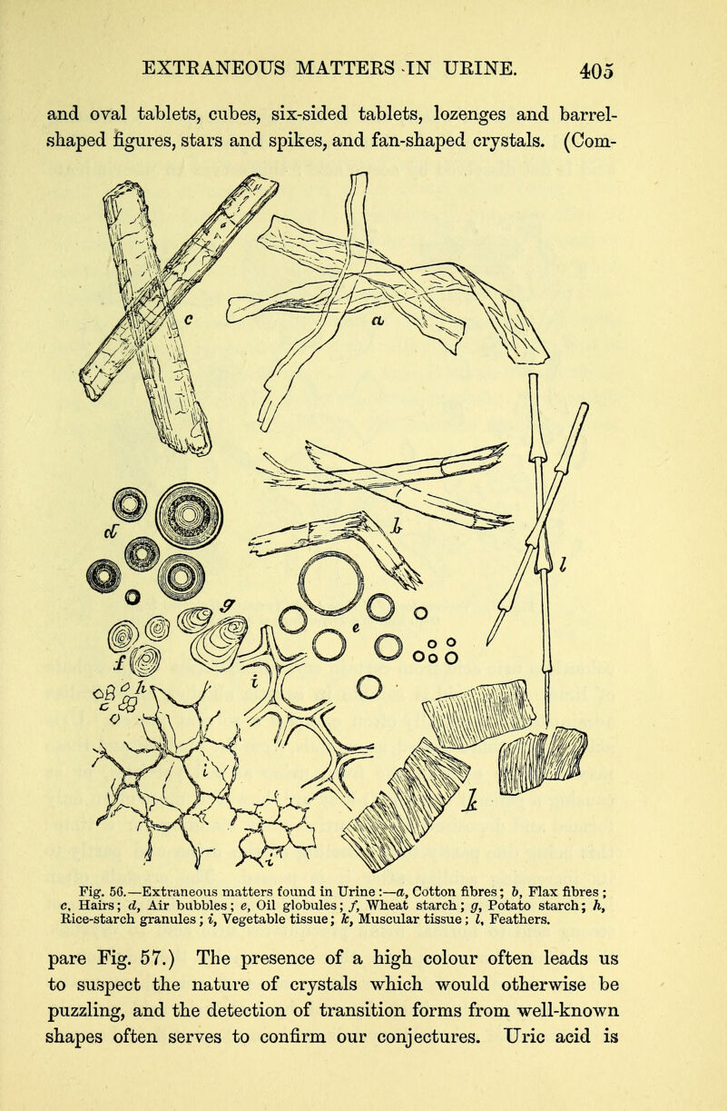 and oval tablets, cubes, six-sided tablets, lozenges and barrel- shaped figures, stars and spikes, and fan-shaped crystals. (Corn- Fig. 56.—Extraneous matters found in Urine :—a, Cotton fibres; b, Flax fibres ; c. Hairs; d, Air bubbles; e, Oil globules; /, Wheat starch; g, Potato starch; h, Rice-starch granules; i, Vegetable tissue; k, Muscular tissue; I, Feathers. pare Fig. 57.) The presence of a high colour often leads us to suspect the nature of crystals which would otherwise be puzzling, and the detection of transition forms from well-known shapes often serves to confirm our conjectures. Uric acid is