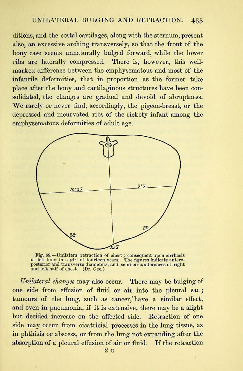 ditions, and the costal cartilages, along with fche sternum, present also, an excessive arching transversely, so that the front of the bony case seems unnaturally bulged forward, while the lower ribs are laterally compressed. There is, however, this well- marked difference between the emphysematous and most of the infantile deformities, that in proportion as the former take place after the bony and cartilaginous structures have been con- solidated, the changes are gradual and devoid of abruptness. We rarely or never find, accordingly, the pigeon-breast, or the depressed and incurvated ribs of the rickety infant among the emphysematous deformities of adult age. Fig. 68. —Unilatera retraction of chest; consequent upon cirrhosis Of left lung in a girl of fourteen years. The figures indicate antero- posterior and transverse diameters, and semi-circumferences of right and left half of chest. (Dr. Gee.) Unilateral changes may also occur. There may be bulging of one side from effusion of fluid or air into the pleural sac; tumours of the lung, such as cancer/ have a similar effect, and even in pneumonia, if it is extensive, there may be a slight but decided increase on the affected side. Retraction of one side may occur from cicatricial processes in the lung tissue, as in phthisis or abscess, or from the lung not expanding after the absorption of a pleural effusion of air or fluid. If the retraction 2 G
