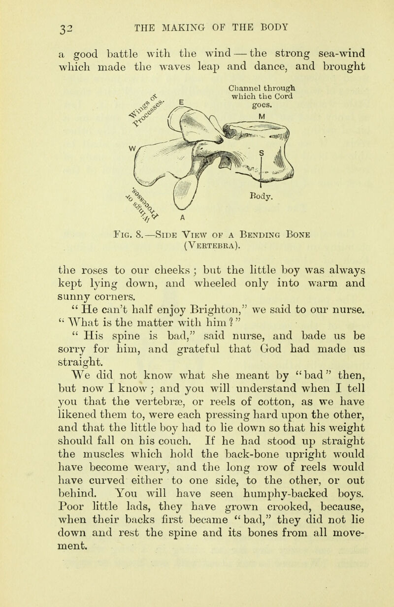 a good battle with the wind — the strong sea-wind which made the waves leap and dance, and brought Channel through Fig. 8.—Side View of a Bending Bone (Vertebra). the roses to our cheeks ; but the little boy was always kept lying down, and wheeled only into warm and sunny corners. He can't half enjoy Brighton, we said to our nurse.  What is the matter with him ?  His spine is bad, said nurse, and bade us be sorry for him, and grateful that God had made us straight. We did not know what she meant by ''bad then, but now I know; and you will understand when I tell you that the vertebrae, or reels of cotton, as we have likened them to, were each pressing hard upon the other, and that the little boy had to lie down so that his weight should fall on his couch. If he had stood up straight the muscles which hold the back-bone upright would have become weary, and the long row of reels would have curved either to one side, to the other, or out behind. You will have seen humphy-backed boys. Poor little lads, they have grown crooked, because, when their backs first became bad, they did not lie down and rest the spine and its bones from all move- ment.