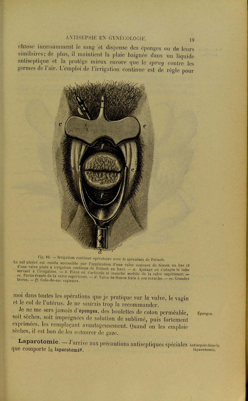 19 chasse incessamment le sang 'et dispense des éponges on de leurs similaires; de plus, il maintient la plaie baignée dans un liquide antiseptique et la protège mieux encore que le spray contre les germes de l'air. L'emploi de l'irrigation continue est de règle pour Fig. 10. - Irrigation continue opératoire avec le spéculum de Fritsch. dwiafvf ntteT?rUiaTSSible,!5ar 1,aPPIicati0» d'une valve concave de Simon en bas et l'firiïlton *at!onp.c°ntlnue,de Fritsch en haut. - a. Ajutage où s'adapte le tube TtortiîèlZTdiï» ~7 Ce 0l' S arUcule le ,nanche mobile de la valve supérieure. _ Sv^ - iï£%X£Ziï£i~ Vi'1Ve dG Sim°n °* à S°» .nanche.-'^. Grandes moi dans toutes les opérations que je pratique sur la vulve, le vagin et le col de l'utérus. Je ne saurais Irop la recommander. Je ne me sers jamais d'épongés, des boulettes de coton perméable, Éponges soit sèches, soit imprégnées de solution de sublimé, puis fortement exprimées, les remplaçant avantageusement. Quand on les emploie sèches, il est bon de les entourer de gaze. Laparotomie, -_J'a,,; ve aux précautions antiseptiques spéciales Antisepsie dan* que comporte lu laparotomie. ' aparolomie.