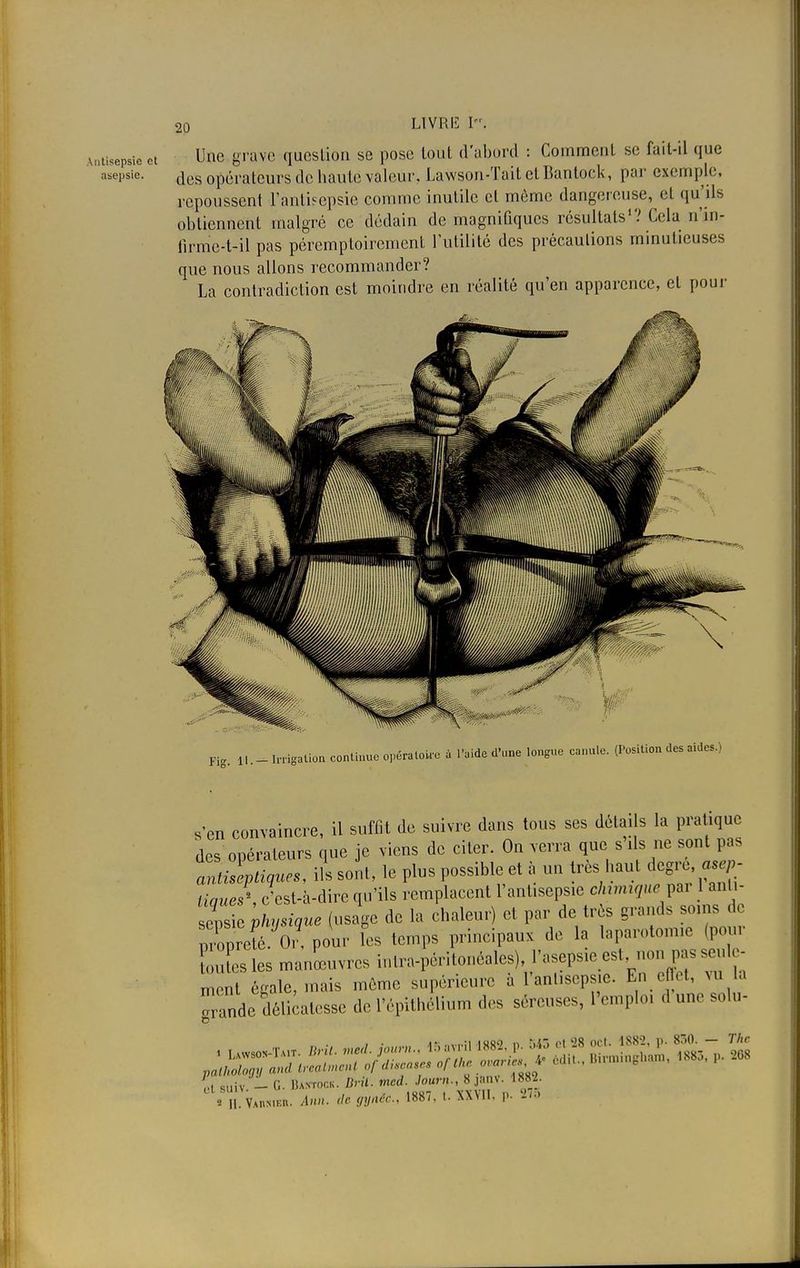 Antisepsie et Une grave question se pose tout d'abord : Comment se fait-il que asepsie. ^es opérateurs de haute valeur, Lawson-ïait elBanlock, par exemple, repoussent l'antisepsie comme inutile cl môme dangereuse, et qu'ils obtiennent malgré ce dédain de magnifiques résultats1'.' Cela n'in- firme-t-il pas péremptoirement l'utilité des précautions minutieuses que nous allons recommander? La contradiction est moindre en réalité qu'en apparence, et pour pio-_ il. — Irrigation continue opératoire i l'oideo'nne longue e.m.lo. (Position ta alte.) s'en convaincre, il suffit de suivre dans tous ses détails la pratique des opérateurs que je viens de citer. On verra que s'ils ne sont pas * soit, le Ph» ^ «t à un très haut degré, tiaues' c'est-à-dire qu'ils remplacent l'antisepsie chimique pu anti- ens ihyXue (usage de la chaleur) et par de très grands soins ,1, Zureté Or pour ifs temps principaux de la laparotomie (pour s i s manœuvres intra-péritonéales), l'asepsie est non pas seule- ment égale, mais même supérieure à l'antisepsie. En effet, vu la ^ande délicatesse de l'épithélium des séreuses, l'emploi d une soin- ■ • a- ..,„;i imr<) n KAS cl l)8 ocl. 1882, p. 850. — The »! Miiv - G. Bastock. Drit. mcd. Journ., 8 janv. 188_A . M. Vaumeu. de gynëC, 1887, t. XXVII. p. '2/.»