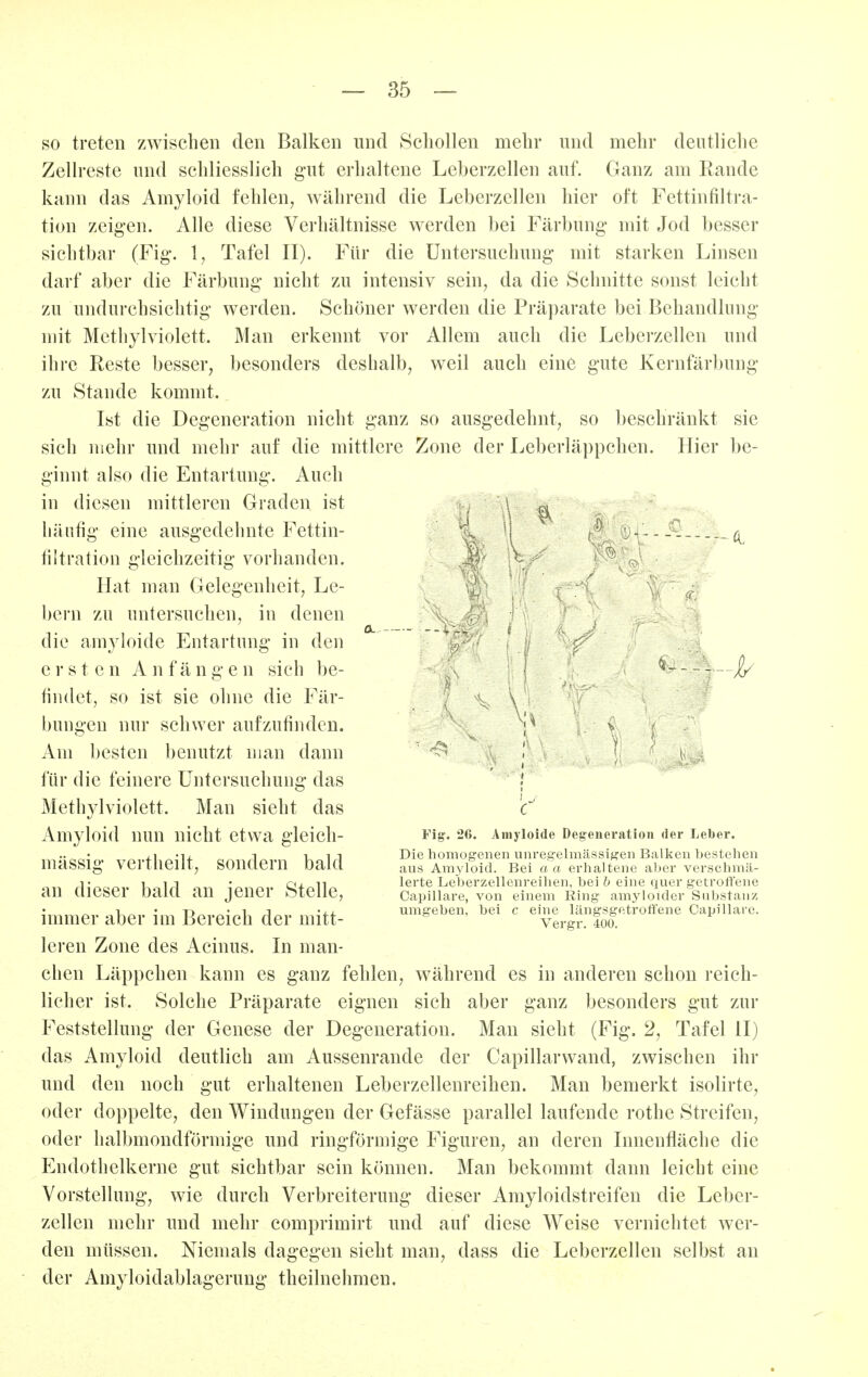 so treten zwischen den Balken und Schollen mehr und mehr deutliche Zellreste und schliesslich gut erhaltene Leberzellen auf. Ganz am Rande kann das Amyloid fehlen, während die Leberzellen hier oft Fcttinfiltra- tion zeigen. Alle diese Verhältnisse werden bei Färbung* mit Jod besser sichtbar (Fig. 1, Tafel II). Für die Untersuchung mit starken Linsen darf aber die Färbung nicht zu intensiv sein, da die Schnitte sonst leicht zu undurchsichtig werden. Schöner werden die Präparate bei Behandlimg mit Methylviolett. Man erkennt vor Allem auch die Leberzellen und ihre Reste besser, besonders deshalb, weil auch eine gute Kernfärbung zu Stande kommt. Ist die Degeneration nicht ganz so ausgedehnt, so beschränkt sie sich mehr und mehr auf die mittlere Zone der Leberläppchen. Hier be- ginnt also die Entartim^-. Auch in diesen mittleren Graden ist häufig eine ausgedehnte Fettin- ^ filtration gleichzeitig vorhanden. Hat man Gelegenheit, Le- bern zu imtersuchen, in denen ÖL.. — » .. die amyloide Entartimg in den ersten Anfängen sieh be- - _ —^ findet, so ist sie ohne die Fär- bungen nur schwer aufzufinden. I ^ Am besten benutzt man dann '< ' i für die feinere Untersuchung das J Methyl violett. Man sieht das c* Amyloid nun nicht etwa gleich- l'ig- 26. Amyloide Degeneration der Leber. ,1 -Ii 1 1^ i/i Die homogenen unregelmässigen Balken bestehen massig vertneilt, sondern DalÜ aus Amyloid. Bei aa erhaltene aber verschmä- !• 1 IT • cii n lerte Leberzellenreihen, bei ö eine quer getroffene an Üieser Daia an jener stelle, Caplllare, von einem Ring amyloitler Substanz ,1.^.,' D^ ^-^1 'i-i. umgeben, bei c eine längsgetroffene Capillare. immer aber im Bereich der mitt- vergr. too. leren Zone des Acinus. In man- chen Läppchen kann es ganz fehlen, während es in anderen schon reich- licher ist. Solche Präparate eignen sich aber ganz besonders gut zur Feststellung der Genese der Degeneration. Mau sieht (Fig. 2, Tafel II) das Amyloid deutlich am Aussenrande der Capillarvvand, zwischen ihr und den noch gut erhaltenen Leberzellenreihen. Man bemerkt isolirte, oder doppelte, den Windungen der Gefässe parallel laufende rothe Streifen, oder halbmondförmige und ringförmige Figuren, an deren Innenfläche die Endothelkerne gut sichtbar sein können. Man bekommt dann leicht eine Vorstellung, wie durch Verbreiterung dieser Amyloidstreifen die Leber- zellen mehr und mehr comprimirt und auf diese Weise vernichtet wer- den müssen. Niemals dagegen sieht man, dass die Leberzellen selbst an der Amyloidablagerung theilnehmen.