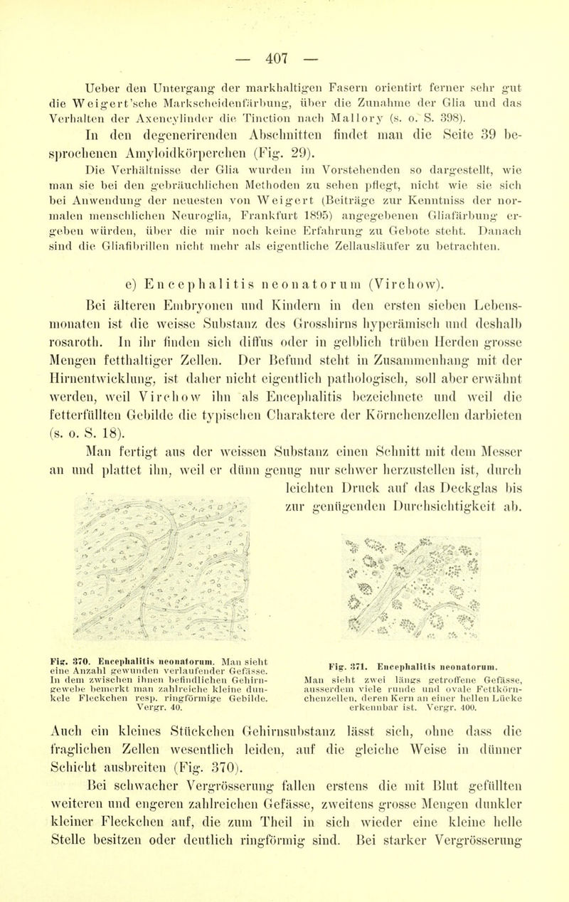 lieber den Untergang der markhaltigen Fasern orientirt ferner sehr gut die Weigert'sche Markscheidentarbung, über die Zunahme der GHa und das Verhalten der Axencylinder die Tinction nach Mallory (s. o. S. 398). In den degenerirenden Absclmitten findet man die Seite 39 be- sprochenen Amyloidkörperclien (Fig. 29). Die Verhältnisse der Glia wurden im Vorstehenden so dargestellt, wie man sie bei den gebräuchlichen Methoden zu sehen pflegt, nicht wie sie sich bei Anwendung der neuesten von Weigert (Beiträge zur Kenntniss der nor- malen menschlichen Neuroglia, Frankfurt 1895) angegebenen Gliafärbung er- geben würden, über die mir noch keine Erfahrung zu Gebote steht. Danach sind die Gliafibrillen nicht mehr als eigentliche Zellausläufer zu betrachten. e) Encephalitis neonatorum (Virchow). Bei älteren Embryonen und Kindern in den ersten sieben Lebens- monaten ist die weisse Substanz des Grossliirns liyperämiscli und deshalb rosaroth. In ihr finden sich diffus oder in gelblich trüben Herden grosse Mengen fetthaltiger Zellen. Der Befund steht in Zusammenhang mit der Hirnentwicklung, ist daher nicht eigentlich pathologisch, soll aber erwähnt werden, weil Virchow ihn als Encephalitis bezeichnete und weil die fetterfiillten Gebilde die typischen Charaktere der Körnchenzellen darbieten (s. 0. S. 18). Man fertigt aus der weissen Substanz einen Schnitt mit dem Messer an und plattet ihn, weil er dünn genug nur schwer herzustellen ist, durch leichten Druck auf das Deckglas bis zur genügenden Durchsichtigkeit ab. ' •  .... - '^9^ ■ ' ;• Fijif. 370. EucephaHtis neoiiatonim. Mau sieht eine Anzahl gewunden verlaufender Gefässe. Fig. 371. Encephalitis neonatorum. In dem zwischen ihnen befindlichen Gehirn- Man sieht zwei längs getroffene Gefässe, gewebe l)emerkt man zahlreiche kleine dun- ausserdem viele runde und ovale Fettkörn- kele Fleckchen resp. ringförmige Gebilde. chenzellen, deren Kern an einer hellen Lücke Vergr. 40. erkennbar ist. Vergr. 400. Auch ein kleines Stückchen Gehirnsubstanz lässt sich, ohne dass die fraglichen Zellen wesentlich leiden, auf die gleiche Weise in dünner Schicht ausbreiten (Fig. 370). Bei schwacher Vergrösserung fallen erstens die mit Blut gefüllten weiteren und engeren zahlreichen Gefässe, zweitens grosse Mengen dunkler kleiner Fleckchen auf, die zum Theil in sich wieder eine kleine helle Stelle besitzen oder deutlich ringförmig sind. Bei starker Vergrösserung