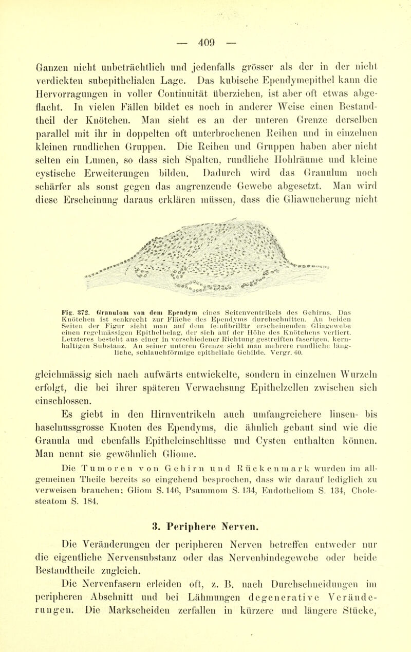 Ganzen nicht unbeträchtlich und jedenfalls grösser als der in der nicht verdickten subepithelialen Lage. Das kubische Ependymepithel kann die Hervorrag-ungen in voller Continuität überziehen, ist aber oft etwas abge- flacht. In vielen Fällen bildet es noch in anderer Weise einen Bestand- theil der Knötchen. Man sieht es an der unteren Grenze derselben parallel mit ihr in doppelten oft unterbrochenen Reihen und in einzelnen kleinen rundlichen Gruppen. Die Reihen und Gruppen haben aber nicht selten ein Lumen, so dass sich Spalten, rundliche Hohlräume und kleine cystische Erweiterungen bilden. Dadurch wird das Granulum noch schärfer als sonst gegen das angrenzende Gewebe abgesetzt. Man wird diese Erscheinung daraus erklären müssen; dass die Gliawucherung nicht Fig. 372. Orniiulom von dem Ependjni eines Seitenventrikels des Gehirns. Das Knötchen ist senkrecht zur Fliiclie des Epciidyms durchschnitten. An beiden Seiten der Figur sieht man auf dem feinfibrillär erscheinenden Gliagrewebe eiJien regelmässig'en Epithelbelag, der sich auf der Höhe des Knötchens verliert. Letzteres besteht aus einer in verschiedener Richtung gestreiften faserigen, kern- haltigen Substanz. An seiner unteren Grenze sieht man mehrere rundliche läng- liche, schlauchförmige epitheliale Gebilde. Vergr. 00. gleichmässig sich nach aufwärts entwickelte, sondern in einzelnen Wurzeln erfolgt, die bei ihrer späteren Verwachsung Epithclzcllen zwischen sich einschlössen. Es giebt in den Hirnventrikeln auch umfangreichere linsen- bis haselnussgrosse Knoten des Epcndyms, die ähnlich gebaut sind wie die Granula und ebenfalls Epitheleinschlüsse und Cysten enthalten können. Man nennt sie gewöhnlich Gliome. Die Tumoren von Gehirn und Rücken m a r k wurden im all- gemeinen Tlieile bereits so eingeliend besprochen, dass wir darauf lediglich zu verweisen brauchen: Gliom S. 146, Psammom S. 134, Endotheliom S. 134, Chole- steatom S. 184. 3. Periphere Nerven. Die Veränderungen der peripheren Nerven betreffen entweder nur die eigentliche Nervensubstanz oder das Nervenbindegewebe oder beide Bestandtheilc zugleich. Die Nervenfasern erleiden oft, z. B. nach Durchschneidungen im peripheren Abschnitt und bei Lähmungen de generative Verände- rungen. Die Markscheiden zerfallen in kürzere und längere Stücke^