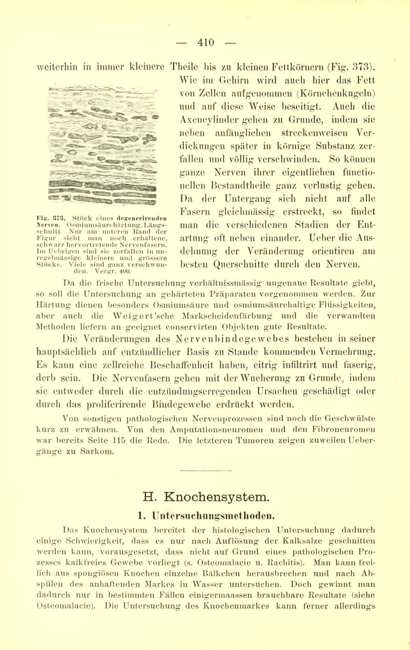 weiterhin in immer kleinere Theile bis zu kleinen Fettkörnern (Fig. 373). Wie im Gehirn wird auch hier das Fett von Zellen aufg-enommen (Körnehenkugeln) und auf diese Weise beseitigt. Auch die Axencylinder gehen zu Grunde, indem sie neben anfänglichen streckenweisen Ver- dickungen später in körnige Substanz zer- fallen und völlig verschwinden. So können ganze Nerven ihrer eigentlichen functio- nellen Bestandtheile ganz verlustig gehen. Da der Untergang sich nicht auf alle Fasern gleichmässig erstreckt, so findet man die verschiedenen Stadien der Ent- artung oft neben einander. Uel)er die Aus- dehnung der Veränderung orientiren am besten Querschnitte durcli den Nerven. Da die frische Untersuchung verhältnissmässig ungenaue Resultate giebt, so soll die Untersuchung an gehärteten Präparaten vorgenommen werden. Zur Härtung dienen besonders Osmiunisäure und osmiumsäurehaltige Flüssigkeiten, aber auch die Weigert'sehe Markscheidenfärbung und die verwandten Methoden liefern an geeignet conservirten Objekten gute Resultate. Die Veränderungen des Nervenbindegewebes bestehen in seiner hauptsächlich auf entzündlicher Basis zu Stande kommenden Vermehrung. Es kann eine zellreiche Beschaffenheit haben, eitrig infiltrirt und faserig, derb sein. Die Nervenfasern gehen mit der Wucherung zu Grunde^ indem sie entweder durch die entzünduugserregenden Ursachen geschädigt oder durch das proliferirende Bindegewebe erdrückt werden. Von sonstigen pathologischen Nervenprozessen sind noch die Geschwülste kurz zu erwähnen. Von den Amputationsneuromen und den Fibroneuromen war bereits Seite 115 die Rede. Die letzteren Tumoren zeigen zuweilen Uel)er- gänge zu Sarkom. H. Knochensystem. 1. Uiitersucliungsiiiethoden. Das Knochensystem bereitet der histologischen Untersuchung dadurch einige Schwierigkeit, dass es nur nach Auflösung der Kalksalze geschnitten werden kann, vorausgesetzt, dass nicht auf Grund eines pathologischen Pro- zesses kalkfreies Gewebe vorliegt (s. Osteomalacie u. Rachitis). Man kann frei- lich aus spongiösen Knochen einzelne Bälkchen herausbrechen und nach Ab- spülen des anhaftenden Markes in Wasser untersuchen. Doch gewinnt man dadurch nur in bestimmten Fällen einigermaassen brauchbare Resultate (siehe Osteomalacie). Die Untersuchung des Knochenmarkes kann ferner allerdings Fig. 373. Stück eines (Icgciii'rirciKh'u AervtMi. Osiniumsäurehiirtuiiir, Läiif^s- schnitt. Nur am unteren Kand der Figur sieht man noch erhaltene, schwarz hervortretende Nervenfasern. Im Uebrigen sind sie zerfaUen in un- regelmässige kleinere und grössere Stücke. Viele sind ganz versehwun- den. Vergr. 400.