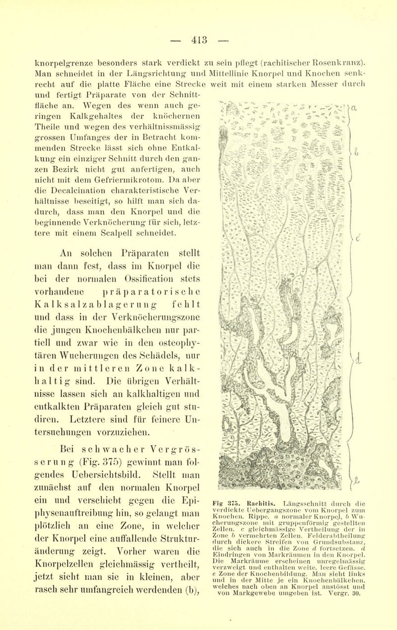 knorpelgrenze besonders stark verdickt Man schneidet in der Längsrichtung- und recht auf die platte Fläche eine Strecke und fertigt Präparate von der Schnitt- fläche an. Wegen des wenn auch ge- ringen Kalkgehaltes der knöchernen Theile und wegen des verhältnissmässig grossen Umfanges der in Betracht kom- menden Streck(i lässt sich ohne Entkal- kung ein einziger Schnitt durch den gan- zen Bezirlv nicht gut anfertigen^ auch nicht mit dem Gefriermikrotom. Da aber die Decalcination charakteristische Ver- hältnisse beseitigt, so hilft man sich da- durch, dass man den Knorpel und die beginnende Verknöcherung für sich, letz- tere mit einem Scalpell schneidet. An solchen Präparaten stellt man dann fest, dass im Knorpel die bei der normalen Ossification stets vorhandene p r ä p a r a t o r i s c Ii e K a 1 k s a 1 z a b 1 a g e r u n g fehl t und dass in der Verknöcherungszone die jungen Knochenbälkchen nur par- tiell und zwar wie in den osteopliy- tären Wucherungen des Schädels, nur in der m i 111 e r e n Zone kalk- haltig sind. Die übrigen Verhält- nisse lassen sich an kalkhaltigen und entkalkten Präparaten gleich gut stu- diren. Letztere sind für feinere Un- tersuchungen vorzuziehen. Bei schwacher V e r g r ö s - s e r u n g (Fig. 375) gewinnt man fol- gendes Uebersichtsbild. Stellt man zunächst auf den normalen Knorpel ein und verschiebt gegen die Epi- physenauftreibung hin, so gelangt man plötzlich an eine Zone, in welcher der Knorpel eine auffallende Struktur- änderung zeigt. Vorher waren die Knorpelzellen gleichmässig vertheilt, jetzt sieht man sie in kleinen, aber rasch sehr umfangreich werdenden (b), zu sein pflegt (rachitischer Rosenkranz). Mittellinie Knorpel und Knochen senk- weit mit einem starken Messer durch i < \ I Fig .375. Rachitis. Längsschnitt durch die verdickte llebergangszone vom Knori)el zum Knochen. Rippe, a normaler Knorpej, b Wu- cherungszone mit gruppenförmig gesteUten ZeUen. c gleichmässige Vertheilung der in Zone b vermehrten Zellen. Felderabtheilung durch dickere Streifen von Grundsubstanz, die sich auch in die Zone d fortsetzen, d Eindringen von Markräumen in den Knorpel. Die Markräume erscheinen unregelmässig verzweigt und entlialten weite, leere Gefässe. e Zone der Knochenbildung. Man sieht links unfl in der Mitte je ein Knochenbälkchen, welches nach oben an Knorpel anstösst und von Markgewebe umgeben ist. Vergr. 30.