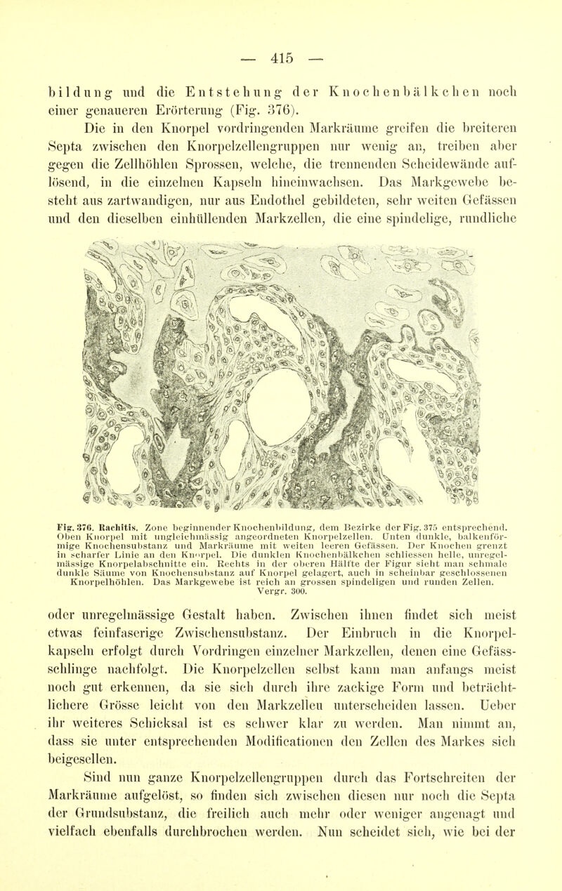 b i 1 d 11 n g und die Entstehung der K n o c b e n b ä l k c h c n noch einer genaueren Erörterung* (Fig. 376). Die in den Knorpel vordringenden Markräume greifen die breiteren Septa zwischen den Knorpelzellengruppen nur wenig an, treiben aber gegen die Zellhöhlen Sprossen, welche, die trennenden Scheidewände auf- lösend; in die einzelnen Kapseln hineinwachsen. Das Markgewebe be- steht aus zartwandigcn, nur aus Endothel gebildeten, sehr weiten Gefässen und den dieselben einhüllenden Markzellen, die eine spindelige, rundliche ' ■ -. Fig-. 376. Rachitis. Zone beginnender Knoclienbildunfr, dem Bezirke der Fig. 375 entsprechend. Oben Knorpel mit ungleiehmilssig angeordneten KnorpelzeUen. Unten dunkle, balkenför- mige Knochensubstanz und Markräume mit weiten leeren Gefässen. Der Knochen grenzt in t^charfer Linie an den Kmu-pel. Die dunklen Knochenbälkchen schliessen helle, unregel- mässige Knorpelabschnitte ein. Rechts in der oberen Hälfte der Figur sieht man schmale dunkle Säume von Knochensubstanz auf Knorpel gelagert, auch in scheinbar geschlossenen Knorpelhöhlen. Das Markgewebe ist reich an grossen spindeligen und runden Zellen. Vergr. 300. oder unregelmässige Gestalt haben. Zwischen ihnen findet sich meist etwas feinfaserige Zwischensubstanz. Der Einbruch in die Knorpel- kapseln erfolgt durch Vordringen einzelner Markzellen, denen eine Gefäss- schlinge nachfolgt. Die Knorpelzcllen selbst kann man anfangs meist noch gut erkennen, da sie sich durch ihre zackige Form und beträcht- lichere Grösse leicht von den Markzelleu unterscheiden lassen, lieber ihr weiteres Schicksal ist es schwer klar zu werden. Man nimmt an, dass sie unter entsprechenden Modificationcn den Zellen des Markes sich beigesellen. Sind nun ganze Knorpelzellengrnppen durch das Fortschreiten der Markräume aufgelöst, so finden sich zwischen diesen nur noch die Septa der Grundsubstanz, die freilich auch mehr oder weniger angenagt und vielfach ebenfalls durchbrochen werden. Nun scheidet sich, wie bei der