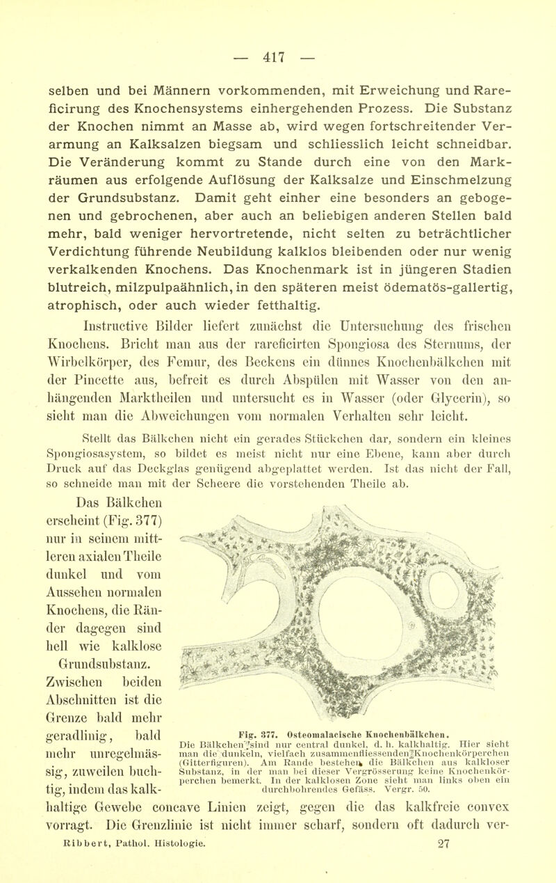 selben und bei Männern vorkommenden, mit Erweichung und Rare- ficirung des Knochensystems einhergehenden Prozess. Die Substanz der Knochen nimmt an Masse ab, wird wegen fortschreitender Ver- armung an Kalksalzen biegsam und schliesslich leicht schneidbar. Die Veränderung kommt zu Stande durch eine von den Mark- räumen aus erfolgende Auflösung der Kalksalze und Einschmelzung der Grundsubstanz. Damit geht einher eine besonders an geboge- nen und gebrochenen, aber auch an beliebigen anderen Stellen bald mehr, bald weniger hervortretende, nicht selten zu beträchtlicher Verdichtung führende Neubildung kalklos bleibenden oder nur wenig verkalkenden Knochens. Das Knochenmark ist in jüngeren Stadien blutreich, milzpulpaähnlich, in den späteren meist ödematös-gallertig, atrophisch, oder auch wieder fetthaltig. Instructive Bilder liefert zunächst die Untersuchung des frischen Knochens. Bricht man aus der rareficirten Spongiosa des Sternums, der Wirbelkörper; des f^emur, des Beckens ein dünnes Knochenbälkchen mit der Pincette aus^ befreit es durch Abspülen mit Wasser von den an- hängenden Marktheilen und untersucht es in Wasser (oder Glycerin), so sieht man die Abweichungen vom normalen Verhalten sehr leicht. Stellt das Bälkchen nicht ein gerades Stückchen dar, sondern ein kleines Spongiosasystem, so bildet es meist nicht nur eine Ebene, kann aber durch Druck auf das Deckglas genügend abgeplattet werden. Ist das nicht der Fall, so schneide man mit der Scheere die vorstehenden Theüe ab. Das Bälkchen erscheint (Fig. 377) nur in seinem mitt- leren axialen Theile dunkel und vom Aussehen normalen Knochens, die Rän- der dagegen sind hell wie kalklose Grundsubstanz. Zwischen beiden Abschnitten ist die Grenze bald mehr geradlinig, bald mehr unregelmäs- sig, zuweilen buch- tig, indem das kalk- haltige Gewebe concave Linien zeigt, gegen die das kalkfreie convex vorragt. Die Grenzlinie ist nicht immer scharf, sondern oft dadurch ver- Ribbert, Pathol. Histologie. 27 Fig. 377. Osteomalacisclie Knochenbälkchen. Die Bälkchen'^sind nur central dunkel, d. Ii. kalkhaltig. Hier sieht man die' dunkeln, vielfach zusammenfliessenden|Knochenkörperchen (Gitterüguren). Am Rande hesteheik die Bälkchen aus kalkloser Substanz, in der man bei dieser Vergrösserung keine Knochenkör- perchen bemerkt. In der kalklosen Zone sieht man links oben ein durchbohrendes Gefäss. Vergr. 50.