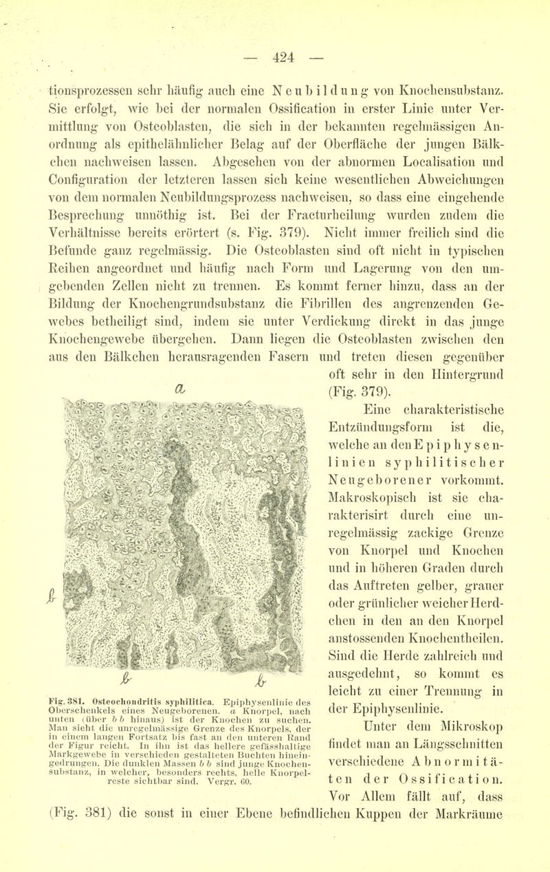 tioDsprozessen sehr häufig auch eine Neubildung* von Knoehensubstanz. Sie erfolgt, wie bei der normalen Ossification in erster Linie unter Ver- mittlung von Osteoblasten, die sich in der bekannten regelmässigen An- ordnung als epithelähnlicher Belag auf der Oberfläche der jungen Bälk- chen nachweisen lassen. Abgesehen von der abnormen Localisation und Configuration der letzteren lassen sich keine wesentlichen Abweichungen von dem normalen Neubildungsprozess nachweisen, so dass eine eingehende Besprechung unnöthig ist. Bei der Fracturheilung wurden zudem die Verhältnisse bereits erörtert (s. Fig. 379). Nicht immer freilich sind die Befunde ganz regelmässig. Die Osteoblasten sind oft nicht in typischen Reihen angeordnet und häufig nach Form und Lagerung von den um- gebenden Zellen nicht zu trennen. Es kommt ferner hinzu, dass an der Bildung der Knochengrundsubstanz die Fibrillen des angrenzenden Ge- webes betheiligt sind, indem sie unter Verdickung direkt in das junge Knochengewebe übergehen. Dann liegen die Osteoblasten zwischen den aus den Bälkchen herausragenden Fasern und treten diesen gegenüber oft sehr in den Hintergrund ^^'S- 379). - Eine charakteristische Entzündungsform ist die, welche an den E p i p h y s e n- 1 i n i e n syphilitischer Neugeborener vorkommt. Makroskopisch ist sie cha- rakterisirt durch eine un- regelmässig zackige Grenze von Knorpel und Knochen und in höheren Graden durch das Auftreten gelber, grauer oder grünlicher weicher Herd- chen in den an den Knorpel anstossenden Knochentheilen. Sind die Herde zahlreich und ausgedehnt, so kommt es leicht zu einer Trennung in der Epiphysenlinie. Unter dem Mikroskop findet man an Längsschnitten verschiedene Abnormitä- ten der Ossification. Vor Allem fällt auf, dass (Fig. 381) die sonst in einer Ebene befindlichen Kuppen der Markräume Fig. 881. Osteochondritis sypliiUtica. Eijiphysenlinie des Oberschenkels eines Neugeborenen, a Knorpel, nach unten (über hb hinaus) ist der Knochen zu suchen. Man sieht die unregelmässige Grenze des Knorpels, der in einem langen Fortsatz bis fast an den unteren Rand der Figur reicht. In ihn ist das hellere gefässhaltige Markgewebe in verschieden gestalteten Buchten hinein- gedrungen. Die dunklen Massen b b sind junge Knochen- substanz, in welcher, besonders rechts, helle Knorpel- reste sichtbar sind. Vergr. GO.