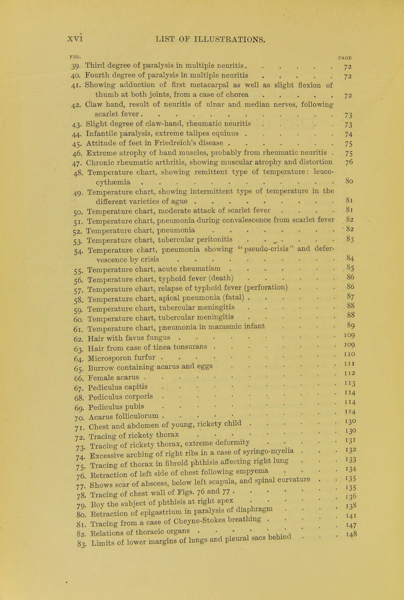 FIO. 39. 40. 41. 42. 43- 44. 45- 46. 47- 48, fever Third degree of paralysis in multiple neuritis. Fourth degree of paralysis in multiple neuritis Showing adduction of first metacarpal as well as slight flexion of thumb at both joints, from a case of chorea Claw hand, result of neuritis of ulnar and median nerves, following scarlet fever Slight degree of claw-hand, rheumatic neuritis .... Infantile paralysis, extreme talipes equinus ..... Attitude of feet in Friedreich's disease Extreme atrophy of hand muscles, probably from rheumatic neuritis Chronic rheumatic arthritis, showing muscular atrophy and distortion Temperature chart, showing remittent type of temperature: leuco cythsemia 49. Temperature chart, showing intermittent type of temperature in the different varieties of ague 50. Temperature chart, moderate attack of scarlet fever 51. Temperature chart, pneumonia during convalescence from scarlet 52. Temperature chart, pneumonia . . . . 53. Temperature chart, tubercular peritonitis 54. Temperature chart, pneumonia showing pseudo-crisis and defer vescence by crisis 55. Temperature chart, acute rheumatism .... 56. Temperature chart, typhoid fever (death) 57. Temperature chart, relapse of typhoid fever (perforation) 58. Temperature chart, apical pneumonia (fatal) . 59. Temperature chart, tubercular meningitis 60. Temperature chart, tubercular meningitis 61. Temperature chart, pneumonia in marasmic infant 62. Hair with favus fungus . 63. Hair from case of tinea tonsurans 64. Microsporon furfur . 65. Burrow containing acarus and eggs 66. Female acarus . Pediculus capitis Pediculus corporis Pediculus pubis Acarus folliculorum Chest and abdomen of young, rickety child . Tracing of rickety thorax Tracing of rickety thorax, extreme deformity Excessive arching of right ribs in a case of syringo-myeha . Tracing of thorax in fibroid phthisis affecting right lung . 76 Eetraction of left side of chest following empyema . . 77. Shows scar of abscess, below left scapula, and spinal curvature 78 Tracing of chest wall of Figs. 76 and 77 . 7o Boy the subject of phthisis at right apex . . 80 Retraction of epigastrium in paralysis of diaphragm 81. Tracing from a case of Cheyne-Stokes breathing . 82. Relations of thoracic organs . . • • ' . 83. Limits of lower margins of lungs and pleural sacs behind 67. 68. 69. 70. 7i- 72. 73- 74- 75- IAOE 72 72 72 73 '73 74 75 75 76 80 81 81 82 • 82 83 84 85 86 86 87 88 88 89 109 109 no 111 112 3 114 114 IT4 130 130 131 132 133 134 135 135 136 138 141 147 148