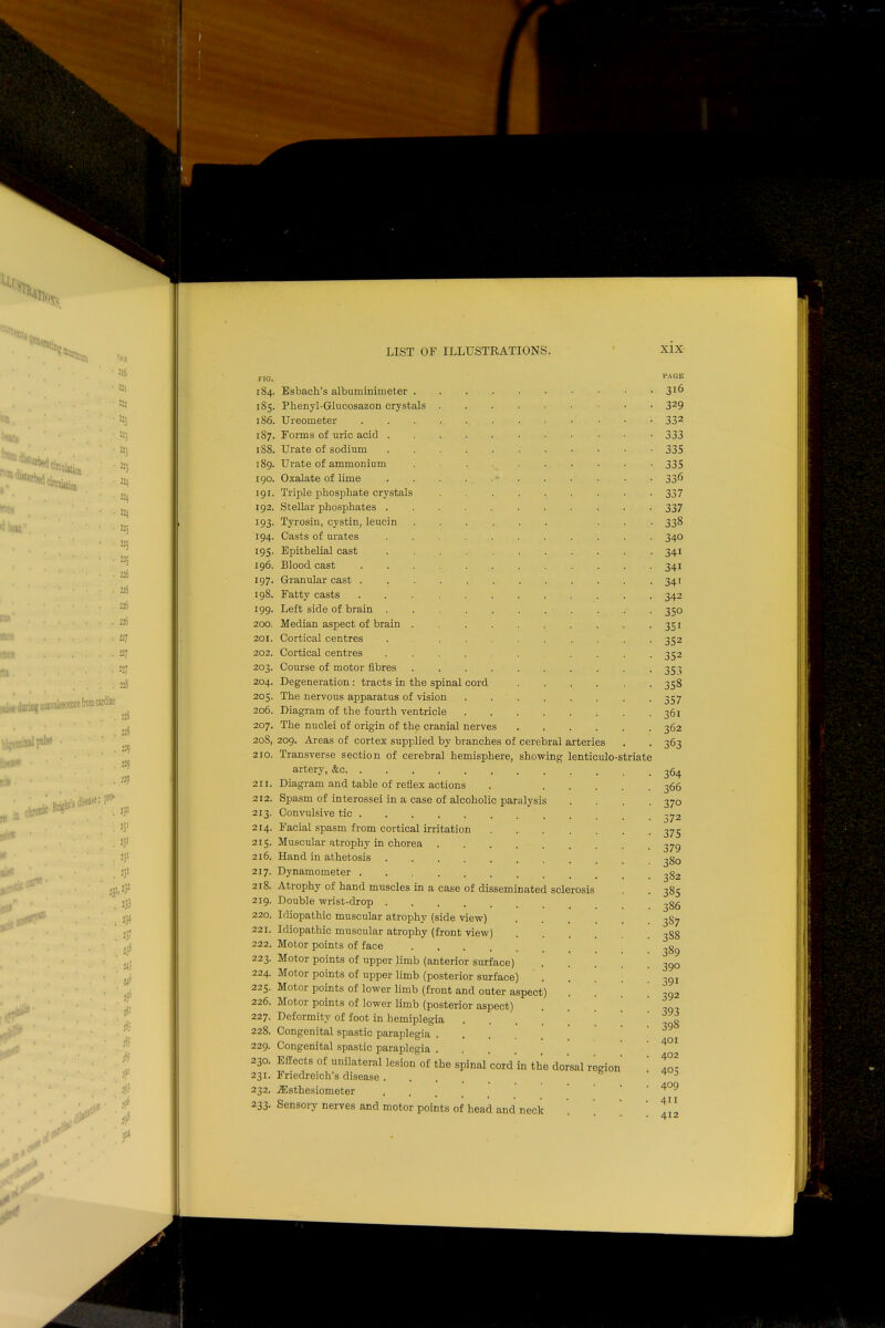 FIG. I84. 185. 186. I87. 188. 189. i go. 191. 192. 193- 194. 195- 196. 197. 198. 199. 200. 201. 202. 203. 204. 205. 206. 207. 208, 210. 211. 212. 213. 214. 215. 2l6. 217. 218. 219. 220. 221. 222. 223. 224. 225. 226. 227. 228. 229. 230. 231. 232. 233- cord Esbach's albuminimeter . Phenyl-Glucosazon crystals Ureometer Forms of uric acid . Urate of sodium Urate of ammonium Oxalate of lime Triple phosphate crystals Stellar phosphates . Tyrosin, cystin, leucin Casts of urates Epithelial cast Blood cast Granular cast . Fatty casts Left side of brain . Median aspect of brain Cortical centres Cortical centres Course of motor fibres Degeneration : tracts in the spinal The nervous apparatus of vision Diagram of the fourth ventricle The nuclei of origin of the cranial nerves 209. Areas of cortex supplied by branches of cerebral arteries Transverse section of cerebral hemisphere, showing lenticulo-striate artery, &c Diagram and table of reflex actions Spasm of interossei in a case of alcoholic paralysis Convulsive tic Facial spasm from cortical irritation Muscular atrophy in chorea Hand in athetosis Dynamometer Atrophy of hand muscles in a case of disseminated sclerosis Double wrist-drop .... Idiopathic muscular atrophy (side view) Idiopathic muscular atrophy (front view) Motor points of face .... Motor points of upper limb (anterior surface) Motor points of upper limb (posterior surface) Motor points of lower limb (front and outer aspect) '. Motor points of lower limb (posterior aspect) Deformity of foot in hemiplegia Congenital spastic paraplegia .... Congenital spastic paraplegia . Effects of unilateral lesion of the spinal cord in the dorsal Friedreich's disease . iEsthesiometer Sensory nerves and motor points of head and neck region PAGE 3l6 329 332 333 335 335 jj 337 337 338 340 34 34 34 342 35o 35 352 352 353 358 357 36i 362 363 364 366 37° 372 375 379 380 382 385 386 3S7 3S8 389 39o 39i 392 393 398 401 402 405 409 411 412