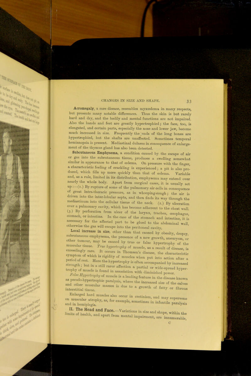 Acromegaly, a rare disease, resembles myxoedema in many respects, but presents many notable diflFerences. Thus the skin is but rarely hard and dry, and the bodily and mental functions are not impaired. Also the hands and feet are greatly hypertrophied; the face, too, is elongated, and certain parts, especially the nose and lower jaw, become much increased in size. Frequently the ends of the long bones are hypertrophied, but the shafts are unaffected. Sometimes temporal hemianopsia is present. Mediastinal dulness in consequence of enlarge- ment of the thymus gland has also been detected. Subcutaneous Emphysema, a condition caused by the escape of air or gas into the subcutaneous tissue, produces a swelling somewhat similar in appearance to that of oedema. On pressure with the finder, a characteristic feeling of crackling is experienced • a pit is also pro- duced, which fills up more quickly than that of oedema. Variable and, as a rule, limited in its distribution, emphysema may extend over nearly the whole body. Apart from surgical cases, it is usually set up :—(i.) By rupture of some of the pulmonary air cells in consequence of great intrathoracic pressure, as in whooping-cough; the air is driven into the inter-lobular septa, and then finds its way through the mediastinum into the cellular tissue of the neck. (2.) By ulceration over a pulmonary cavity, which has become adherent to the chest wall (3-) By perforation from ulcer of the larynx, trachea, oesophagus stomach, or intestine. In the case of the stomach and intestine it is necessary for the affected part to be glued to the abdominal 'wall otherwise the gas will escape into the peritoneal cavity Local increase in size, other than that caused by obesity, dropsy subcutaneous emphysema, the presence of a new growth, aneurysm or other tumour, may be caused by true or false hypertrophy of the muscular tissue. True hypertrophy of muscle, as a result of disease, is ymnS T\ °CrS  Th°mS6n'S diS6aSe' the characteristic symptom of which is rigidity of muscles when put into action after a Eli -tt •Her: Thyperfcrophy is often ^ s length but m a still rarer affection a partial or wide-spread hyper- trophy of muscle is found in association with diminished power P as p^fwf \-£ mUSf 6.iS a f6ature in *» disease known as pseudohypertrophic paralysis, where the increased size of the calves masses is due to a ^ °f « and in hemiplegia ' P^' S°metlm6S m lnfantile P^lysis c i