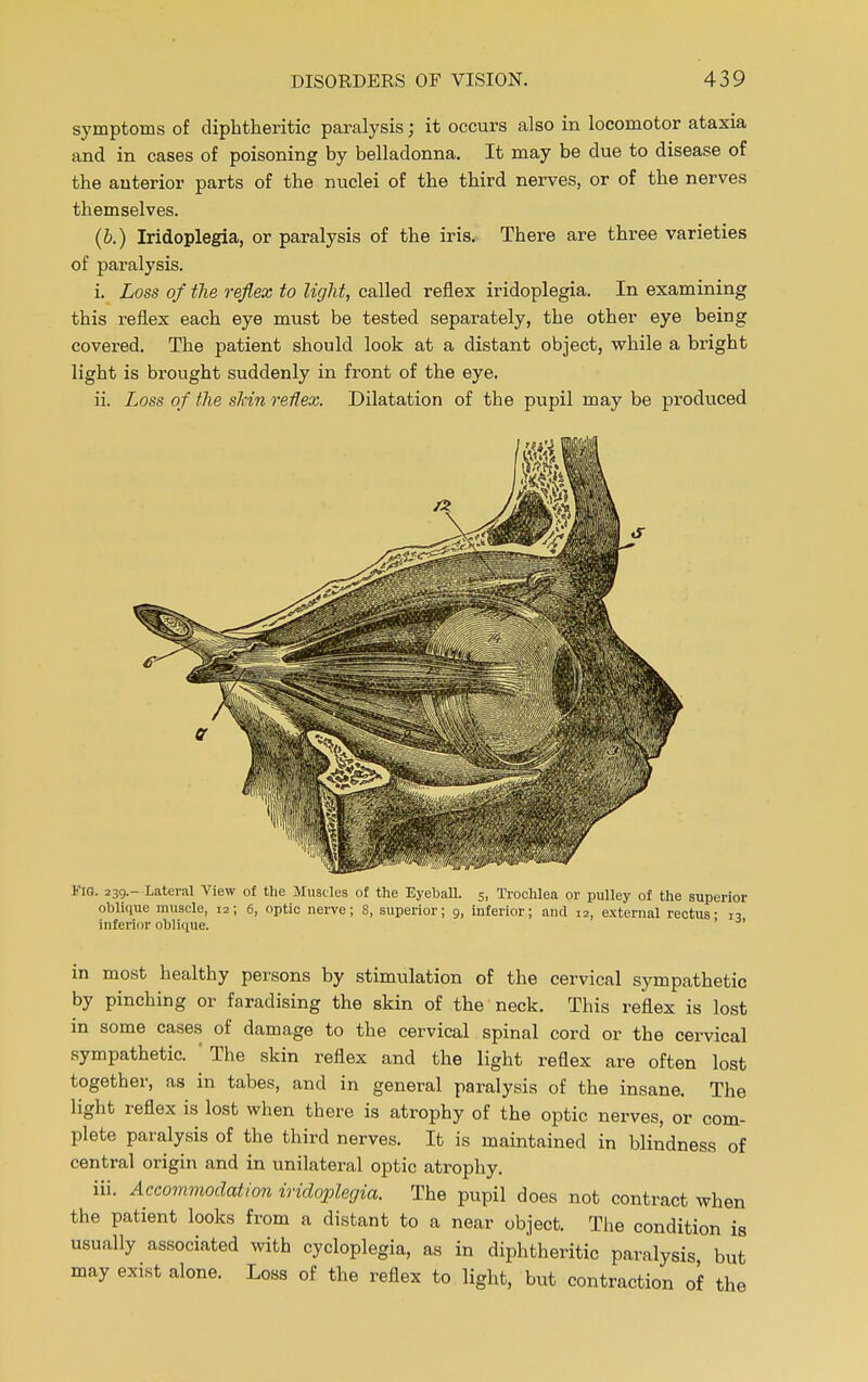 symptoms of diphtheritic paralysis; it occurs also in locomotor ataxia and in cases of poisoning by belladonna. It may be due to disease of the anterior parts of the nuclei of the third nerves, or of the nerves themselves. (&.) Iridoplegia, or paralysis of the iris. There are three varieties of paralysis. i. Loss of the reflex to light, called reflex iridoplegia. In examining this reflex each eye must be tested separately, the other eye being covered. The patient should look at a distant object, while a bright light is brought suddenly in front of the eye. ii. Loss of the skin reflex. Dilatation of the pupil may be produced Via. 239.- Lateral View of the Muscles of the Eyeball. 5, Trochlea or pulley of the superior oblique muscle, 12; 6, optic nerve; 8, superior; 9, inferior; and 12, external rectus- 13 inferior oblique. ' in most healthy persons by stimulation of the cervical sympathetic by pinching or faradising the skin of the neck. This reflex is lost in some cases of damage to the cervical spinal cord or the cervical sympathetic. ' The skin reflex and the light reflex are often lost together, as in tabes, and in general paralysis of the insane. The light reflex is lost when there is atrophy of the optic nerves, or com- plete paralysis of the third nerves. It is maintained in blindness of central origin and in unilateral optic atrophy. iii. Accommodation iridoplegia. The pupil does not contract when the patient looks from a distant to a near object. The condition is usually associated with cycloplegia, as in diphtheritic paralysis but may exist alone. Loss of the reflex to light, but contraction of the