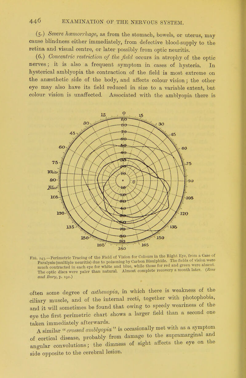 (5.) Severe hcemorrhage, as from the stomach, bowels, or uterus, may cause blindness either immediately, from defective blood-supply to the retina and visual centre, or later possibly from optic neuritis. (6.) Concentric restriction of the field occurs in atrophy of the optic nerves; it is also a frequent symptom in cases of hysteria. In hysterical amblyopia the contraction of the field is most extreme on the anaesthetic side of the body, and affects colour vision; the other eye may also have its field reduced in size to a variable extent, but colour vision is unaffected. Associated with the amblyopia there is — =-90 ion mo Fig. ^.-Perimetric Tracing of the Field of Vision for Colours in the Right Eye from a Case of Paralysis (multiple neuritis) due to poisoning by Carbon Bisulphide. The fields of vision were much contracted in each eye for white and blue, while those for red and green were absent. The optic discs were paler than natural. Almost complete recovery a month later. (Boss and Bury, p. 192.) often some degree of asthenopia, in which there is weakness of the ciliary muscle, and of the internal recti, together with photophobia, and it will sometimes be found that owing to speedy weariness of the eye the first perimetric chart shows a larger field than a second one taken immediately afterwards. A similar « crossed amblyopia  is occasionally met with as a symptom of cortical disease, probably from damage to the supramarginal and angular convolutions; the dimness of sight affects the eye on the side opposite to the cerebral lesion.