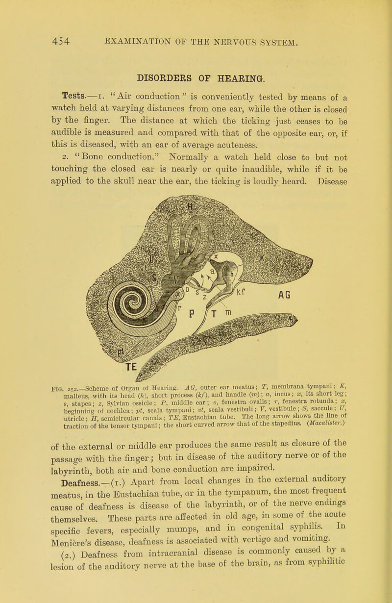 DISORDERS OF HEARING. Tests.—i. Air conduction is conveniently tested by means of a watch held at varying distances from one ear, while the other is closed by the finger. The distance at which the ticking just ceases to be audible is measured and compared with that of the opposite ear, or, if this is diseased, with an ear of average acuteness. 2. Bone conduction. Normally a watch held close to but not touching the closed ear is nearly or quite inaudible, while if it be applied to the skull near the ear, the ticking is loudly heard. Disease FIG. 252.—Scheme of Organ of Hearing. AG, outer ear meatus; T, membrana tympani; K, malleus, with its head (h), short process (fc/), and handle (m); a, incus; x, its short leg; s, stapes; 2, Sylvian ossicle; P, middle ear; 0, fenestra ovalis; r, fenestra rotunda; x, ben-inning of cochlea; pt, scala tympani; vt, scala vestibuli; V, vestibule ; S, saccule; IT, utricle; H, semicircular canals; TE, Eustachian tube. The long arrow shows the line of traction of the tensor tympani; the short curved arrow that of the stapedius. (STacahster.) of the external or middle ear produces the same result as closure of the passage with the finger; but in disease of the auditory nerve or of the labyrinth, both air and bone conduction are impaired. Deafness. —(1.) Apart from local changes in the external auditory meatus, in the Eustachian tube, or in the tympanum, the most frequent cause of deafness is disease of the labyrinth, or of the nerve endings themselves. These parts are affected in old age, in some of the acute specific fevers, especially mumps, and in congenital syphilis. In Meniere's disease, deafness is associated with vertigo and vomiting. (2 ) Deafness from intracranial disease is commonly caused by a lesion of the auditory nerve at the base of the brain, as from syphilitic