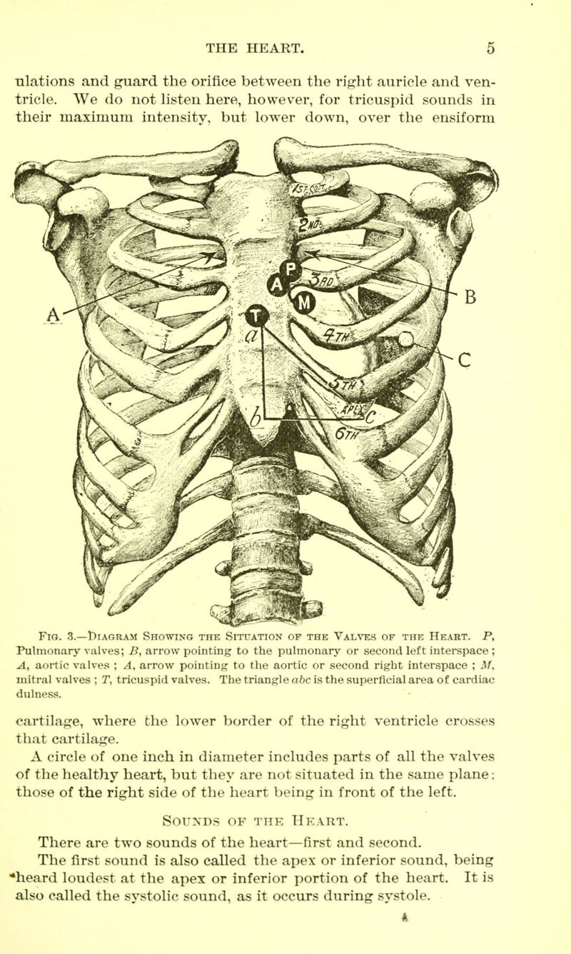 ulations and guard the orifice between the rij^ht auricle and ven- tricle. We do not listen here, however, for tricuspid sounds in their maximum intensity, but lower down, over the ensiform Fig. 3.—t)iAGRAM Sno-mNG the Situation of the Valves of the Heart. P, Pulmonary valves; i?, arrow pointing to the pulmonary or second left interspace ; A, aortic valves ; A, arrow pointing to the aortic or second right interspace ; M, mitral valves ; T, tricuspid valves. The triangle oftc is the superficial area of cardiac dulness. cartilaf^e, where the lower border of the right ventricle crosses that cartilarje. A circle of one inch in diameter includes parts of all the valves of the healthy heart, but they are not situated in the same plane; those of the right side of the heart being in front of the left. SOUXDS OF THE HEART. There are two sounds of the heart—first and second. The first sound is also called the apex or inferior sound, being •heard loudest at the apex or inferior portion of the heart. It is also called the systolic sound, as it occurs during systole.