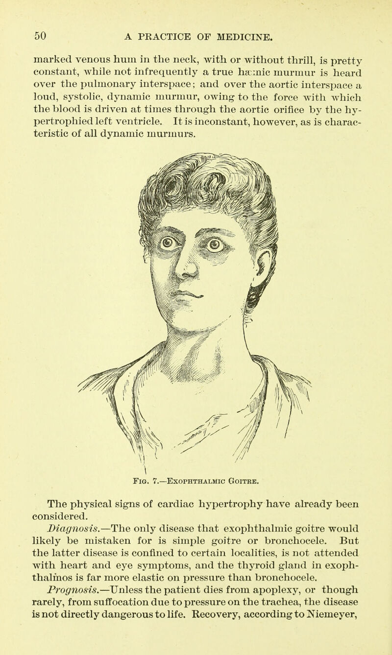 marked venous hum in the neck, with or without thrill, is pretty constant, while not infrequently a true hscmic murmur is heard over the pulmonary interspace; and over the aortic interspace a loud, systolic, dynamic murmur, owing to the force with which the blood is driven at times through the aortic orifice by the hy- pertrophied left ventricle. It is inconstant, however, as is charac- teristic of all dynamic murmurs. Fig. 7.—Exophthalmic Goitre. The physical signs of cardiac hypertrophy have already been considered. Diagnosis.—The only disease that exophthalmic goitre would likely be mistaken for is simple goitre or bronchocele. But the latter disease is confined to certain localities, is not attended with heart and eye symptoms, and the thyroid gland in exoph- thalmos is far more elastic on pressure than bronchocele. Prognosis.—Unless the patient dies from apoplexy, or though rarely, from suffocation due to pressure on the trachea, the disease is not directly dangerous to life. Recovery, according to Niemeyer,