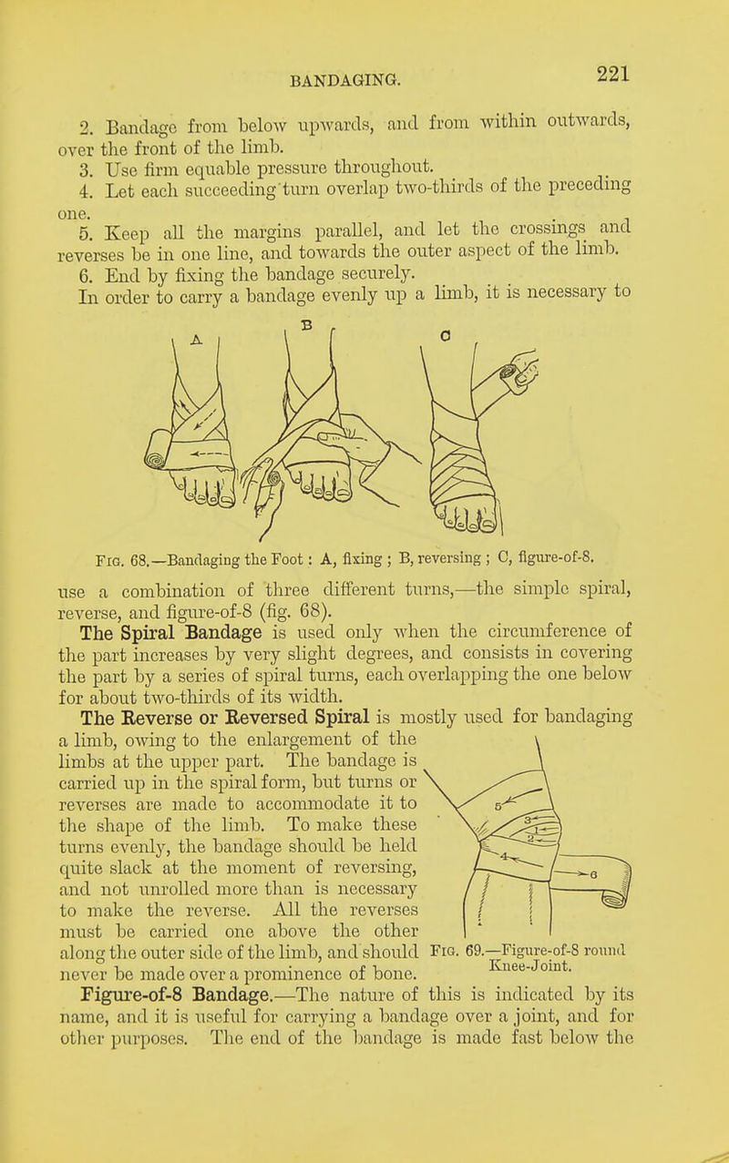 2. Bandage from below upwards, and from Avithin outwards, over tlie front of the limb. 3. Use firm equable pressure throughout. 4. Let each succeeding timi overlap two-thirds of the precednig one. . ^ 5. Keep all the margins parallel, and let the crossmgs and reverses be in one line, and towards the outer aspect of the limb. 6. End by fixing the bandage securel3^ In order to carry a bandage evenly up a limb, it is necessary to Fig. 68.—Bandaging the Foot: A, fixing ; B, reversing ; C, figiire-of-8. use a combination of three difi'erent turns,—the simple spiral, reverse, and figiu'e-of-S (fig. 68). The Spiral Bandage is used only when the circumference of the part increases by very slight degrees, and consists in covering the part by a series of spiral turns, each overlapping the one below for about two-thirds of its width. The Reverse or Reversed Spiral is mostly used for bandaging a limb, OAving to the enlargement of the limbs at the upper part. The bandage is carried up in the spiral form, but turns or reverses are made to accommodate it to the shape of the limb. To make these turns evenly, the bandage should be held quite slack at the moment of reversuig, and not unrolled more than is necessary to make the reverse. All the reverses must be carried one above the other along the outer side of the limb, and should Fio- 69.—Figure-of-8 round never be made over a prominence of bone. Kuee-Joint. Figiire-of-8 Bandage.—The nature of this is indicated by its name, and it is useful for carrying a bandage over a joint, and for other purposes. Tlie end of the bandage is made fast beloAV the