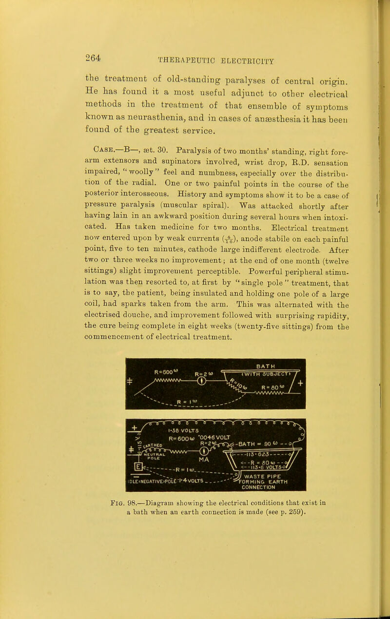 the treatment of old-standing paralyses of central origin. He has found it a most useful adjunct to other electrical methods in the treatment of that ensemble of symptoms known as neurasthenia, and in cases of anaesthesia it has been found of the greatest service. Case.—B—, set. 30. Paralysis of two months' standing, right fore- arm extensors and supinators involved, wrist drop, K.D. sensation impaired, woolly feel and numbness, especially over the distribu- tion of the radial. One or two painful points in the course of the posterior interosseous. History and symptoms show it to be a case of pressure paralysis (muscular spiral). Was attacked shortly after having lain in an awkward position during several hours when intoxi- cated. Has taken medicine for two months. Electrical treatment now entered upon by weak currents (^~), anode stabile on each painful point, five to ten minutes, cathode large indifferent electrode. After two or three weeks no improvement; at the end of one month (twelve sittings) slight improvement perceptible. Powerful peripheral stimu- lation was then resorted to, at first by  single pole  treatment, that is to say, the patient, being insulated and holding one pole of a large coil, had sparks taken from the arm. This was alternated with the electrised douche, and improvement followed with surprising rapidity, the cure being complete in eight weeks (twenty-five sittings) from the commencement of electrical treatment. Fig. 98.—Diagram showing the electrical conditions that exist in a bath when an earth connection is made (see p. 259).