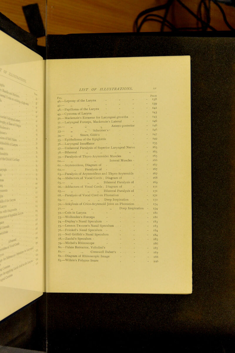 ^ OF , • '^lisofLaryns . ^ the Cricoid Cariilase ih • rosi '.jlSypbiliW^') Lai): 100 I-'4 1? 130 I]' L/ST OF ILLUSTRATIONS. K:g. 46. —Leprosy of the Larynx 47. — 48. 49- 50. 51- 52.- 53- - 54- - 55- - 56- 57-- 58.- 59- 60. - 61. - 62. - 63-- 64.- 65- G6.- 67. - 68. - 69. - 70. - 71-- 72.- 73- - 74- - 75- - 76.- 77-- 78- 79-- 80. - 81. - 82. - 83- Papilloma of the Larynx Cystoma of Larynx Mackenzie's Ecraseur for Laryngeal growths Laryngeal Forceps, Mackenzie's Lateral Antero-posterior „ ,, Schrotter's • Snare, Gibb's Epithelioma of the Epiglottis ■Laryngeal Insufflator - - - ■Unilateral Paralysis of Superior Laryngeal Nerve -Bilateral ,, ,.  -Paralysis of Thyro-Arytenoidei Muscles Interni Muscles - -Arytenoideus, Diagram of - ,, Paralysis of - -Paralysis of Arytenoideus and Thyro-Arytenoids -Abductors of Vocal Cords ; Diagram of ,, ,. ,, Bilateral Paralysis of -Adductors of Vocal Cords ; Diagram of ,, ,, ,, Bilateral Paralysis of ■Paralysis of Vocal Cord on Phonation Deep Inspiration -Ankylosis of Crico-Arytenoid Joint on Phonation ,, ,, ,, Deep Inspiration -Coin in Larynx - - - - -Wolfenden's Forceps -Duplay's Nasal Speculum -Lennox Frowne's Nasal Speculum -Frankel's Nasal Speculum - - - -Neil Griffith's Nasal Speculum -Zaufal's Speculum - - - . -Michel's Rhinoscope - - - -Palate Retractor, Voltolini's ,, ,, Cressvvell Baber's -Diagram of Rhinoscopic Image -Wilkin's Polypus Snare XV Page 13S 139 142 M3 145 146 146 146 147 149 155 165 165 165 166 167 167 167 168 i6g 171 171 172 172 174 174 181 181 183 183 184 184 185 186 187 187 18S iq6