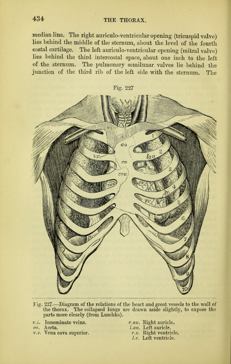 median line. The right anriculo-ventricular opening (tricuspid valye) lies behind the middle of the sternum, about the level of the fourth costal cartilage. The left auriculo-ventricular opening (mitral valve) lies behind the third intercostal space, about one inch to the left of the sternum. The pulmonary semilunar valves lie behind the junction of the third rib of the left side with the sternum. The Fig. 227 Fig. 227.—Diagram of the relations of the heart and great vessels to the wall of the thorax. The collapsed lungs are drawn aside slightly, to expose the parts more clearly (from Lusehka). v.i. Innominate veins. r.au. Right auricle. ao. Aorta. l.au. Left auricle. v.c. Yena cava superior. r.v. Right ventricle. I.v. Left ventricle.