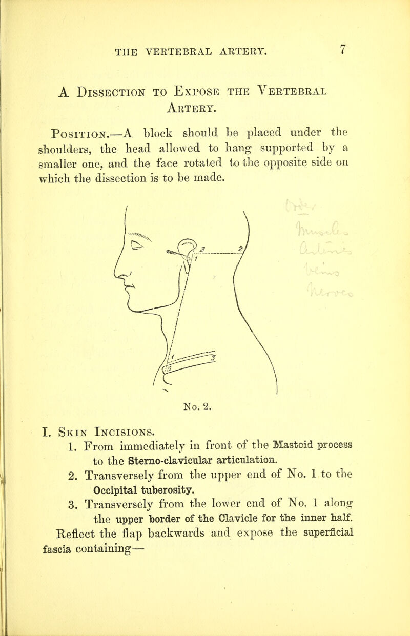 A Dissection to Expose the Vertebral Artery. Position.—A block should be placed under the shoulders, the head allowed to hang supported by a smaller one, and the face rotated to the opposite side on which the dissection is to be made. No. 2. I. Skin Incisions. 1. From immediately in front of the Mastoid process to the Sterno-clavicular articulation. 2. Transversely from the upper end of No. 1 to the Occipital tuberosity. 3. Transversely from the lower end of No. 1 along the upper border of the Clavicle for the inner half. Eeflect the flap backwards and expose the superficial fascia containing—