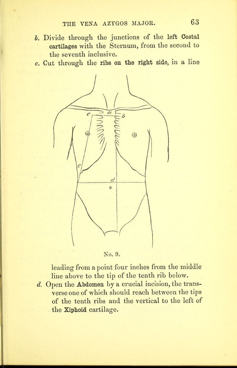 b. Divide through the junctions of the left Costal cartilages with the Sternum, from the second to the seventh inclusive. c. Cut through the ribs on the right side, in a line No. 9. leading from a point four inches from the middle line above to the tip of the tenth rib below. d. Open the Abdomen by a crucial incision, the trans- verse one of which should reach between the tips of the tenth ribs and the vertical to the left of the Xiphoid cartilage.