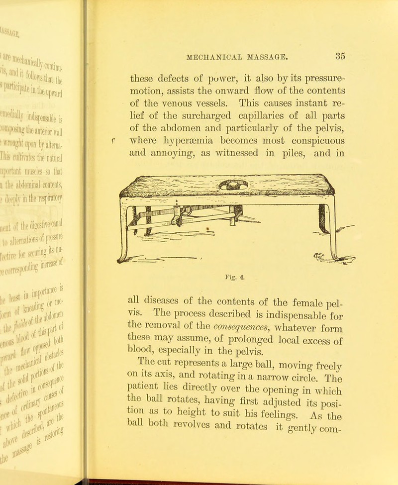 these defects of power, it also by its pressure- motion, assists the onward flow of the contents of the venous vessels. This causes instant re- lief of the surcharged capillaries of all parts of the abdomen and particularly of the pelvis, r where hyperaemia becomes most conspicuous and annoying, as witnessed in piles, and in all diseases of the contents of the female pel- vis. The process described is indispensable for the removal of the consequences, whatever fonn these may assume, of prolonged local excess of blood, especially in the pelvis. The cut represents a large baU, moving freely on its axis, and rotating in a narrow circle. The patient lies directly over the opening in which the ball rotates, having first adjusted its posi- tion as to heiglit to suit his feehngs. As the baU both revolves and rotates it gently com-