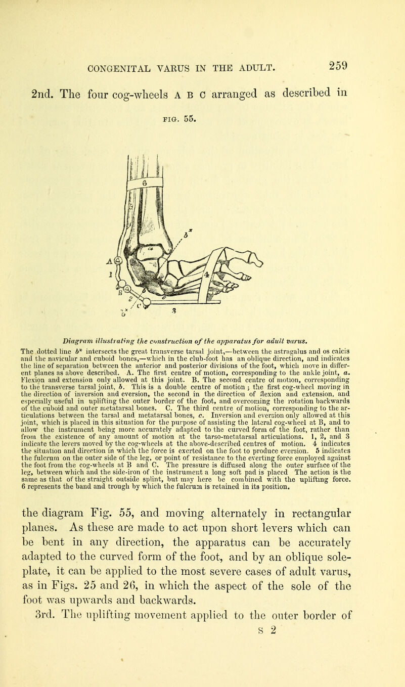 2nd. The four cog-wlieels ABC arranged as described in The dotted line b* intersects the great transverse tarsal joint,—between tJie astragalus and os calci3 and the navicular and cuboid bones,—vi-]iich in the club-foot has an oblique direction, and indicates the line of separation between the anterior and posterior divisions of the foot, which move in differ- ent planes as above described. A. The first centre of motion, corresponding to the ankle joint, a. Flexion and extension only allowed at this joint. B. The second centre of motion, corresponding to the transverse tarsal joint, h. This is a double centre of motion ; the first cog-wheel moving in the direction of inversion and eversion, the second in the direction of ilexion and extension, and especially useful in uplifting the outer border of the foot, and overcoming the rotation backwards of the cuboid and outer metatarsal bones. C. The third centre of motion, corresponding to the ar- ticulations between the tarsal and metatarsal bones, c. Inversion and eversion only allowed at this joint, which is placed in this situation for the purpose of assisting the lateral cog-wheel at B, and to allow the instrument being more accurately adapted to the curved form of the foot, rather than from the existence of any amount of motion at the tarso-raetatarsal articulations. 1, 3, and 3 indicate the levers moved by the cog-wheels at the above-described centres of motion. 4 indicates the situation and direction in which the force is exerted on tlie foot to produce eversion. 5 indicates the fulcrum on the outer side of the leg, or point of resistance to the everting force employed against the foot from the cog-wheels at B and C. The pressure is diffused along the outer surface of the leg, between wliich and the side-iron of the instrument a long soft pad is placed The action is the same as that of the straight outside splint, but may here be combined with the uplifting force. 6 represents the baud and trough by which the fulcruai is retained in its position. the diagram Fig. 55, and moving alternately in rectangular planes. As these are made to act upon short levers which can be bent in any direction, the apparatus can be accurately adapted to the curved form of the foot, and by an oblique sole- plate, it can be applied to the most severe cases of adult varus, as in Figs. 25 and 26, in which the aspect of the sole of the foot was upwards and backAvards. 3rd. The uplifting movement applied to the outer border of Fia. 55. Diagram illustrating the cmstruction of the apparatus for adult varus. s 2