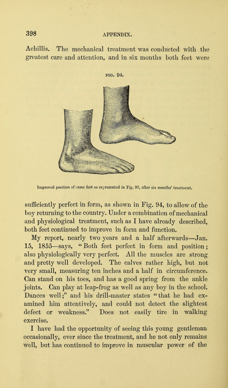 Achillis. The mechanical treatment was conducted with the greatest care and attention, and in six months both feet were Fia. 94. Improved position of same feet as represented in Fig. 93, after six months' treatment. sufficiently perfect in form, as shown in Fig. 94, to allow of the boy returning to the country. Under a combination of mechanical and physiological treatment, such as I have already described, both feet continued to improve in form and function. My report, nearly two years and a half afterwards—Jan. 15, 1855—says,  Both feet perfect in form and position; also physiologically very perfect. All the muscles are strong and pretty well developed. The calves rather high, but not very small, measuring ten inches and a half in circumference. Can stand on his toes, and has a good spring from the ankle joints. Can play at leap-frog as well as any boy in the school. Dances well; and his drill-master states that he had ex- amined him attentively, and could not detect the slightest defect or weakness. Does not easily tire in walking exercise. I have had the opportunity of seeing this young gentleman occasionally, ever since the treatment, and he not only remains well, but has continued to improve in muscular power of the