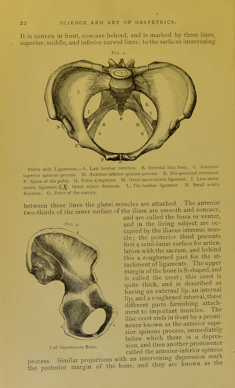 i It is convex in front, concave behind, and is marked by three lines, superior, middle, and inferior curved lines; to the surfaces intervening Fig. Pelvis with Ligaments.—A. Last lumbar vertebra. B. Internal iliac fossa. C Anterior- superior spinous process. D. Anterior-inferior spinous process. E. Ilio-pectineal eminence. F. Spine of the pubis. G. Pubic symphysis. H. Great sacro-sciatic ligament. I. Less sacro- sciatic ligament.^- Great sciatic foramen. L. Ilio-lumbar ligament. N. Small sciatic foramen. O. Point of the coccyx. between these lines the glutei muscles are attached. The anterior two-thirds of the inner surface of the ilium are smooth and concave, and are called the fossa or venter, ftg. 2. and in the living subject are oc- cupied by the iliacus internus mus- cle ; the posterior third presents first a semi-lunar surface for articu- lation with the sacrum, and behind this a roughened part for the at- tachment of ligaments. The upper margin of the bone is S-shaped, and is called the crest; this crest is quite thick, and is described as having an external lip, an internal lip, and a roughened interval, these different parts furnishing attach- ment to important muscles. The iliac crest ends in front by a promi- nence known as the anterior supe- rior spinous process, immediately below which there is a depres- sion, and then another prominence called the anterior-inferior spinous nrocess Similar projections with an intervening depression mark the posterior margin of the bone, and they are known as the Left Innominate Bone.