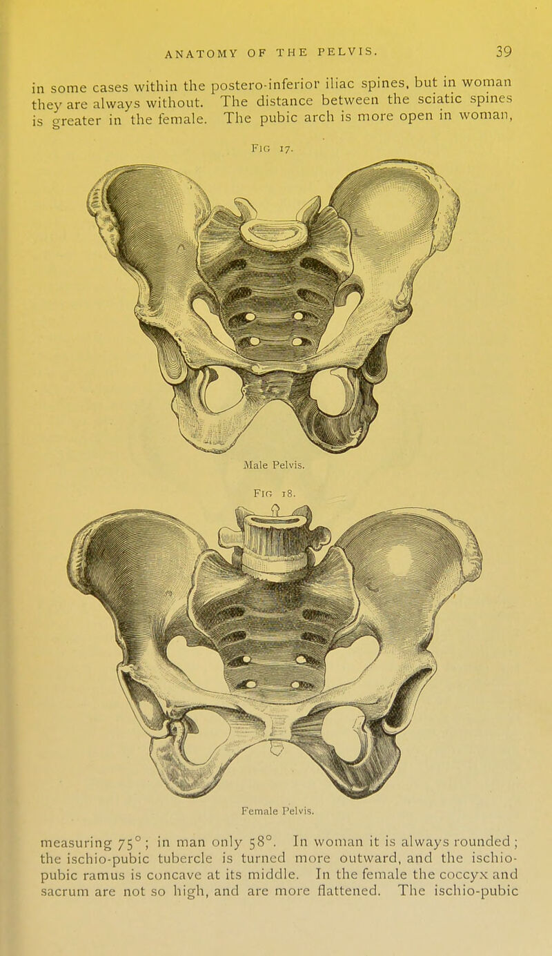 in some cases within the postero-inferior iliac spines, but in woman they are always without. The distance between the sciatic spines is greater in the female. The pubic arch is more open in woman, Fig 17. Female Pelvis. measuring 750 ; in man only 580. In woman it is always rounded ; the ischio-pubic tubercle is turned more outward, and the ischio- pubic ramus is concave at its middle. In the female the coccyx and sacrum are not so high, and are more flattened. The ischio-pubic