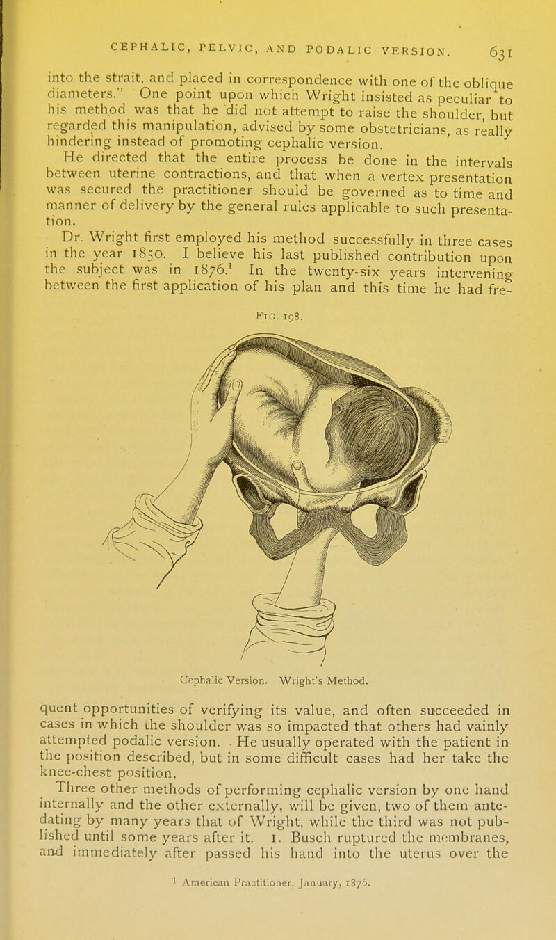 into the strait, and placed in correspondence with one of the oblique diameters. One point upon which Wright insisted as peculiar to his method was that he did not attempt to raise the shoulder, but regarded this manipulation, advised by some obstetricians, as really hindering instead of promoting cephalic version. He directed that the entire process be done in the intervals between uterine contractions, and that when a vertex presentation was secured the practitioner should be governed as to time and manner of delivery by the general rules applicable to such presenta- tion. Dr. Wright first employed his method successfully in three cases in the year 1850. I believe his last published contribution upon the subject was in 1876.1 In the twenty-six years intervening between the first application of his plan and this time he had fre- Fig. 198. Cephalic Version. Wright's Method. quent opportunities of verifying its value, and often succeeded in cases in which the shoulder was so impacted that others had vainly attempted podalic version. . He usually operated with the patient in the position described, but in some difficult cases had her take the knee-chest position. Three other methods of performing cephalic version by one hand internally and the other externally, will be given, two of them ante- dating by many years that of Wright, while the third was not pub- lished until some years after it. I. Busch ruptured the mo:mbranes, and immediately after passed his hand into the uterus over the American Practitioner, January, 1876.