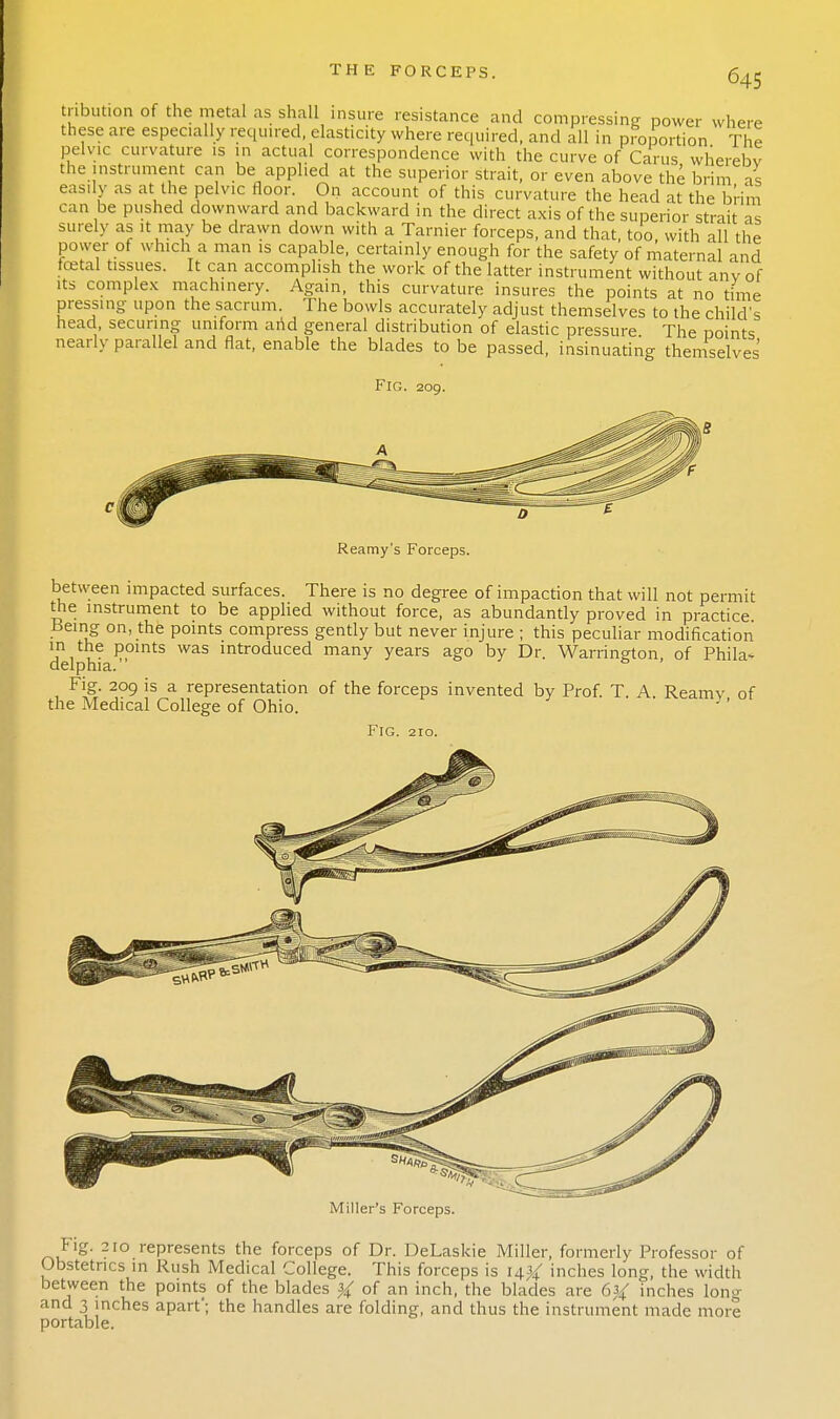 tribution of the metal as shall insure resistance and compressing power where these are especially required elasticity where required, and all in proportion The pelvic curvature is in actual correspondence with the curve of Carus wherebv the mstrument can be applied at the superior strait, or even above the brim as easily as at the pelvic floor. On account of this curvature the head at the brim can be pushed downward and backward in the direct axis of the superior strait as surely as it may be drawn down with a Tarnier forceps, and that, too with all the power of which a man is capable, certainly enough for the safety of maternal and foetal tissues. It can accomplish the work of the latter instrument without anv of its complex machinery. Again, this curvature insures the points at no time pressing upon the sacrum. The bowls accurately adjust themselves to the child's head securing uniform arid general distribution of elastic pressure. The noints nearly parallel and flat, enable the blades to be passed, insinuating themselves Fig. 209. Reamy's Forceps. between impacted surfaces. There is no degree of impaction that will not permit the instrument to be applied without force, as abundantly proved in practice being on, the points compress gently but never injure ; this peculiar modification jn,,e *?,0ints was introduced many years ago by Dr. Warrington, of Phila- delphia. Fig. 209 is a representation of the forceps invented by Prof. T. A Reamv of the Medical College of Ohio. y Fig. 210. Pig. 210 represents the forceps of Dr. DeLaskie Miller, formerly Professor of Obstetrics in Rush Medical College. This forceps is 14^ inches long, the width between the points of the blades % of an inch, the blades are 6% inches long and 3 inches apart'; the handles are folding, and thus the instrument made more portable.