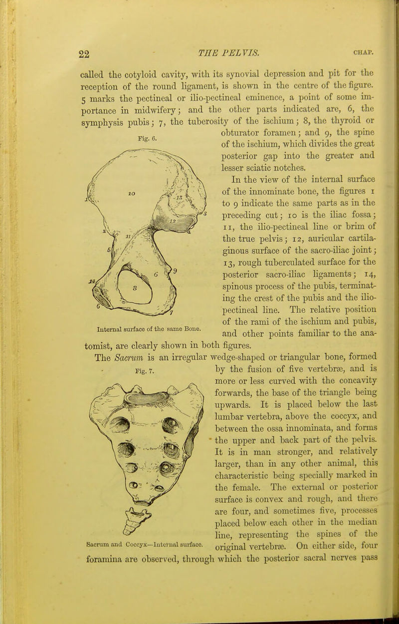 r 22 W£ PELVIS. CHAP. Fig. 0. called the cotyloid cavity, with its synovial depression and pit for the reception of the round ligament, is shown in the centre of the figure. 5 marks the pectineal or ilio-pcctineal eminence, a point of some im- portance in midwifery; and the other parts indicated are, 6, the symphysis pubis; 7, the tuberosity of the ischium; 8, the thyroid or obturator foramen; and 9, the spine of the ischium, which divides the great posterior gap into the greater and lesser sciatic notches. In the view of the internal surface of the innominate bone, the figures 1 to 9 indicate the same parts as in the preceding cut; 10 is the iliac fossa; 11, the ilio-pectineal line or brim of the true pelvis; 12, auricular cartila- ginous surface of the sacro-iliac joint; 13, rough tuberculated surface for the posterior sacro-iliac ligaments; 14, spinous process of the pubis, terminat- ing the crest of the pubis and the ilio- pectineal line. The relative position of the rami of the ischium and pubis, and other points familiar to the ana- tomist, are clearly shown in both figures. The Sacrum is an irregular wedge-shaped or triangular bone, formed by the fusion of five vertebras, and is more or less curved with the concavity forwards, the base of the triangle being upwards. It is placed below the last lumbar vertebra, above the coccyx, and between the ossa mnominata, and forms ■ the upper and back part of the pelvis. It is in man stronger, and relatively larger, than hi any other animal, this characteristic being specially marked in the female. The external or posterior surface is convex and rough, and there are four, and sometimes five, processes placed below each other in the median line, representing the spines of the sacrum and Coccyx-intmiai surface, original vertebra. On either side, four foramina are observed, through which the posterior sacral nerves pass Internal surface of the same Bone. Kg. r.