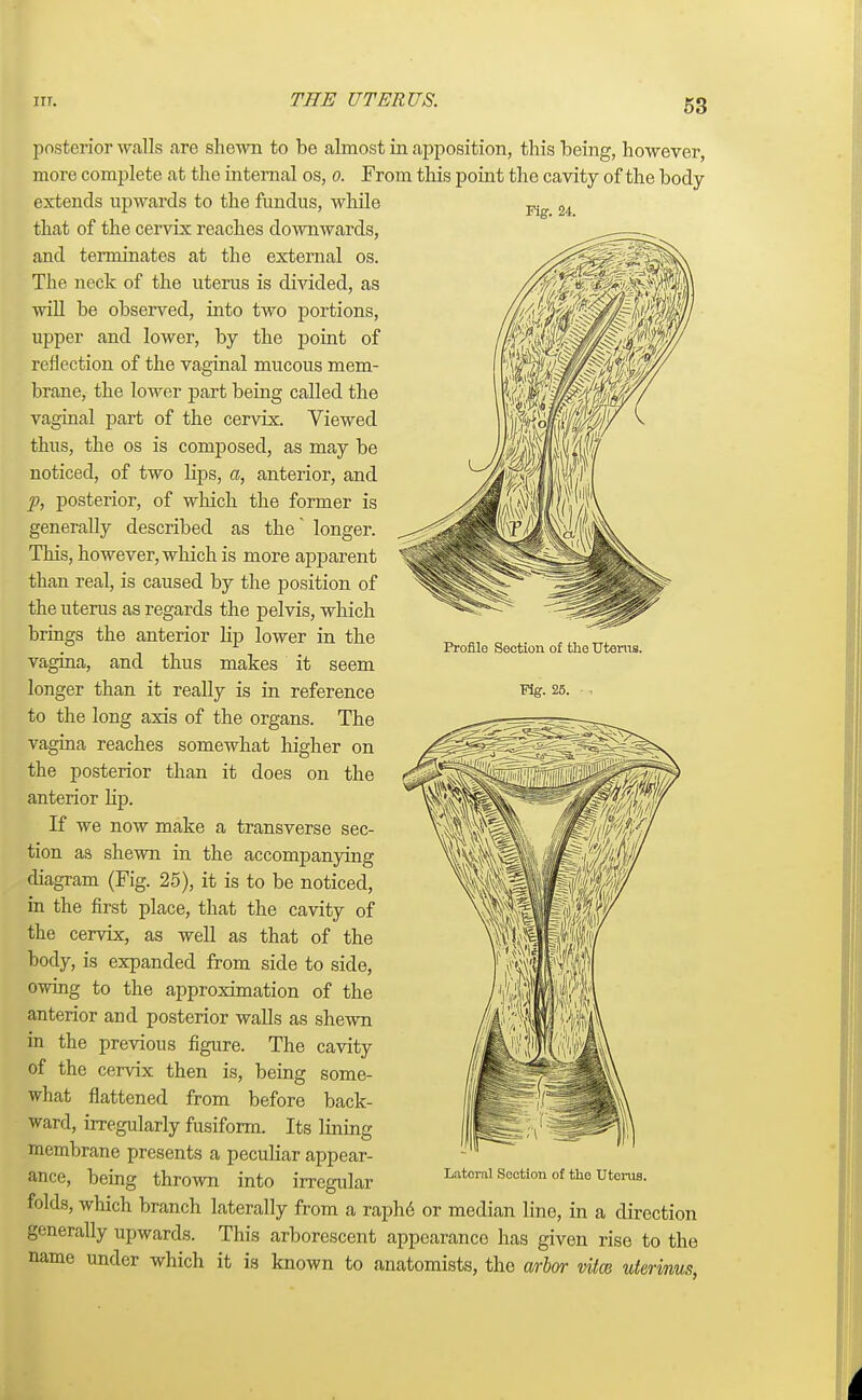 posterior walls are shewn to be almost in apposition, this being, however, more complete at the internal os, o. From this point the cavity of the body extends upwards to the fundus, while Fig 24 that of the cervix reaches downwards, and terminates at the external os. The neck of the uterus is divided, as will be observed, into two portions, upper and lower, by the point of reflection of the vaginal mucous mem- brane, the lower part being called the vaginal part of the cervix. Viewed thus, the os is composed, as may be noticed, of two lips, a, anterior, and p, posterior, of which the former is generally described as the' longer. This, however, which is more apparent than real, is caused by the position of the uterus as regards the pelvis, which brings the anterior lip lower in the vagina, and thus makes it seem longer than it really is in reference to the long axis of the organs. The vagina reaches somewhat higher on the posterior than it does on the anterior hp. If we now make a transverse sec- tion as shewn in the accompanying diagram (Fig. 25), it is to be noticed, in the first place, that the cavity of the cervix, as well as that of the body, is expanded from side to side, owing to the approximation of the anterior and posterior walls as shewn in the previous figure. The cavity of the cervix then is, being some- what flattened from before back- ward, irregularly fusiform. Its lining membrane presents a peculiar appear- ance, being thrown into irregular folds, which branch laterally from a raphe or median line, in a direction generally upwards. This arborescent appearance has given rise to the Profile Section of the Uterus. Fig. 25. . Lateral Section of the Uterus. name under which it is known to anatomists, the arbor vitce uterinus,