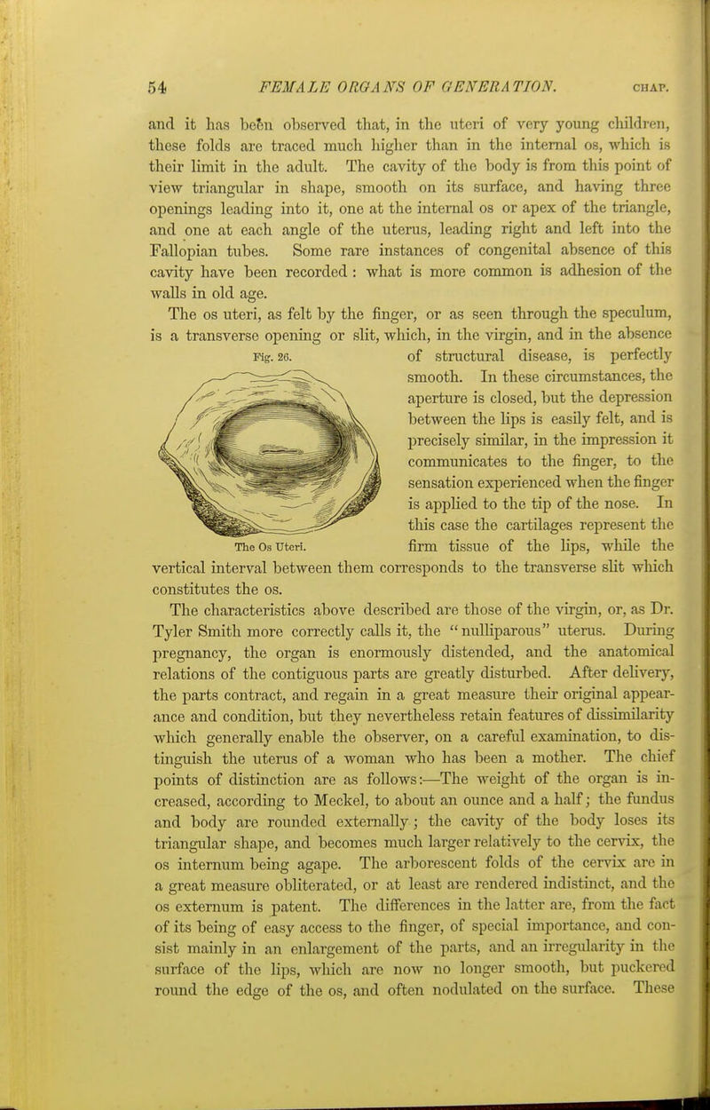 and it has been observed that, in the uteri of very young children, these folds are traced much higher than in the internal os, which is their limit in the adult. The cavity of the body is from this point of view triangular in shape, smooth on its surface, and having three openings leading into it, one at the internal os or apex of the triangle, and one at each angle of the uterus, leading right and left into the Fallopian tubes. Some rare instances of congenital absence of this cavity have been recorded : what is more common is adhesion of the walls in old age. The os uteri, as felt by the finger, or as seen through the speculum, is a transverse opening or slit, which, in the virgin, and in the absence of structural disease, is perfectly smooth. In these circumstances, the aperture is closed, but the depression between the lips is easily felt, and is precisely similar, in the impression it communicates to the finger, to the sensation experienced when the finger is applied to the tip of the nose. In this case the cartilages represent the firm tissue of the hps, while the vertical interval between them corresponds to the transverse slit which constitutes the os. The characteristics above described are those of the virgin, or, as Dr. Tyler Smith more correctly calls it, the nulliparous uterus. During pregnancy, the organ is enormously distended, and the anatomical relations of the contiguous parts are greatly disturbed. After delivery, the parts contract, and regain in a great measure their original appear- ance and condition, but they nevertheless retain features of dissimilarity which generally enable the observer, on a careful examination, to dis- tinguish the uterus of a woman who has been a mother. The chief points of distinction are as follows:—The weight of the organ is in- creased, according to Meckel, to about an ounce and a half; the fundus and body are rounded externally; the cavity of the body loses its triangular shape, and becomes much larger relatively to the cervix, the os internum being agape. The arborescent folds of the cervix are in a great measure obliterated, or at least are rendered indistinct, and the os externum is patent. The differences in the latter are, from the fact of its being of easy access to the finger, of special importance, and con- sist mainly in an enlargement of the parts, and an irregularity in the surface of the lips, which are now no longer smooth, but puckered round the edge of the os, and often nodulated on tho surface. These Fig. 26. The Os Uteri.
