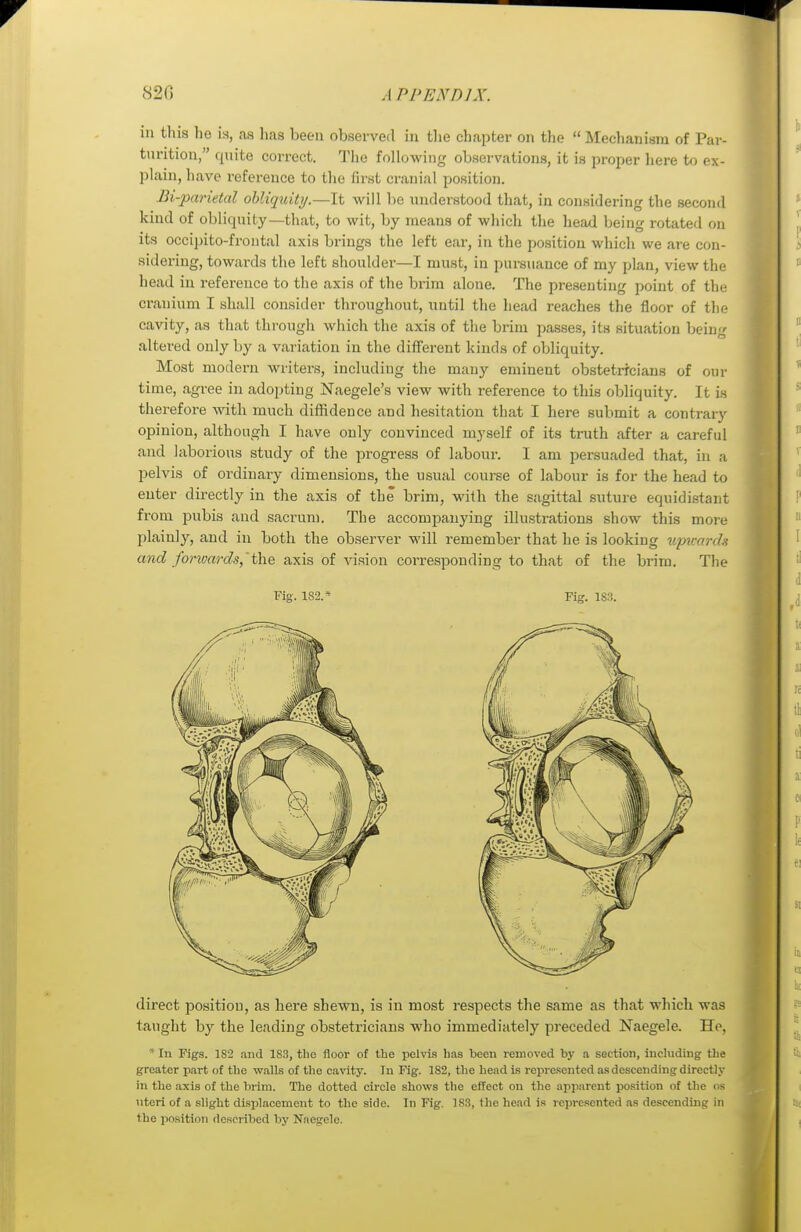 in this he is, as has been observed in the chapter on the Mechanism of Par- turition, quite correct. The following observations, it is proper here to ex- plain, have reference to the first cranial position. Bi-parietal obliquity.—It will be understood that, in considering the second kind of obliquity—that, to wit, by means of which the head being rotated on its occipitofrontal axis brings the left ear, in the position which we are con- sidering, towards the left shoulder—I must, in pursuance of my plan, view the liead in reference to the axis of the brim alone. The presenting point of the cranium I shall consider throughout, until the head reaches the floor of the cavity, as that through which the axis of the brim passes, its situation bein«- altered only by a variation in the different kinds of obliquity. Most modern writers, including the many eminent obstetricians of our time, agree in adopting Naegele's view with reference to this obliquity. It is therefore with much diffidence and hesitation that I here submit a contrary opinion, although I have only convinced myself of its truth after a careful and laborious study of the progress of labour. I am persuaded that, in a pelvis of ordinary dimensions, the usual course of labour is for the head to enter directly in the axis of the brim, with the sagittal suture equidistant from pubis and sacrum. The accompanying illustrations show this more plainly, and in both the observer will remember that he is looking upwards and forwards,'the axis of vision corresponding to that of the brim. The Fig. 182.* Fig. 183. direct position, as here shewn, is in most respects the same as that which was taught hy the leading obstetricians who immediately preceded Naegele. He, * In Figs. 1S2 and 1S3, the floor of the pelvis lias been removed by a section, including the greater part of the walls of the cavity. In Fig. 182, the head is represented as descending directly in the axis of the brim. The dotted circle shows the effect on the apparent position of the os uteri of a slight displacement to the side. In Fig. 1S3, the head is represented as descending in the position described by Naegele.