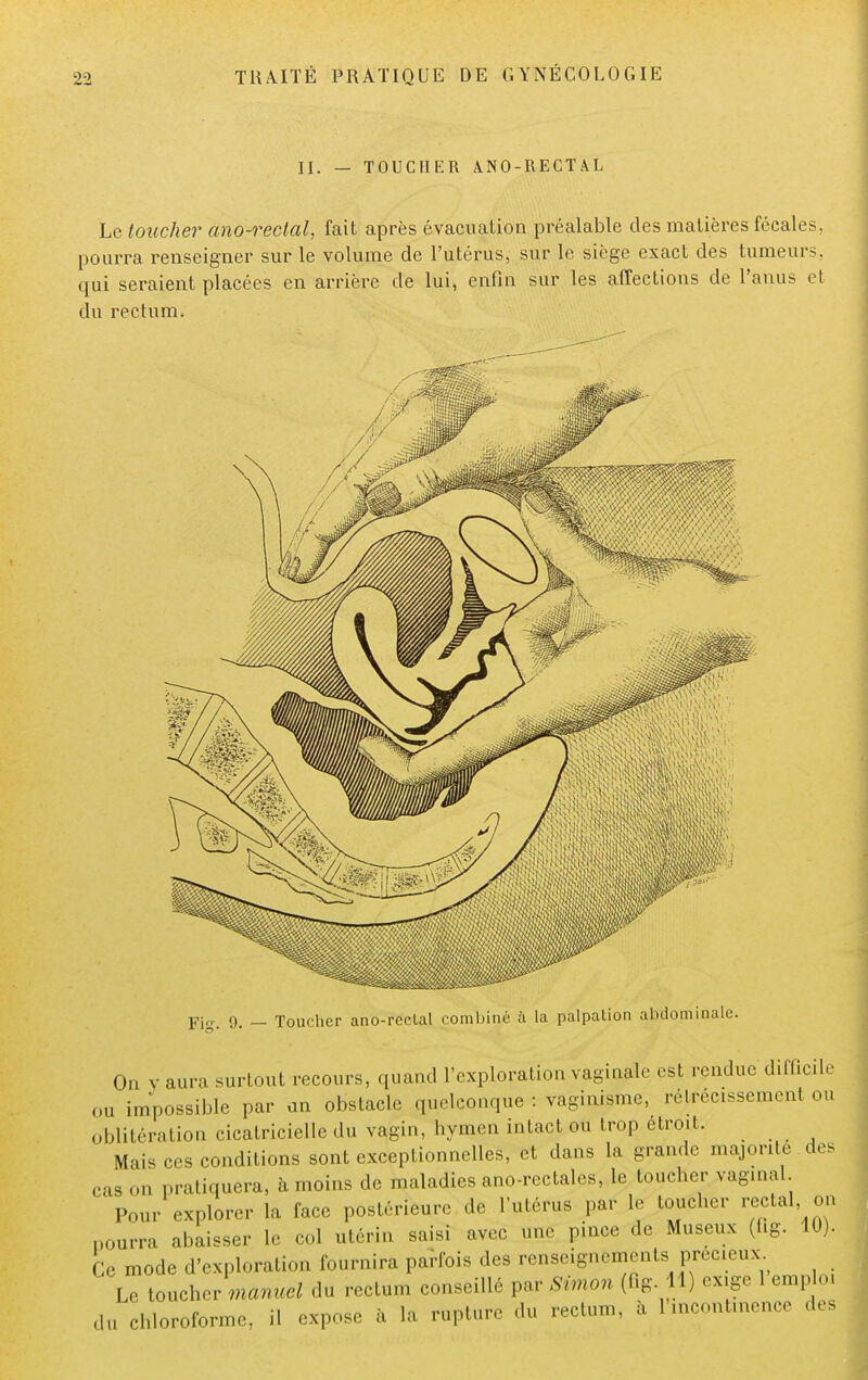 II. — TOUCHER A.NO-RECTAL Le toucher ano-rectal, fait après évacuation préalable des matières fécales, pourra renseigner sur le volume de l'utérus, sur le siège exact des tumeurs, qui seraient placées en arrière de lui, enfin sur les affections de l'anus et du rectum. Fig. i). — Toucher ano-reclal combiné à la palpation abdominale. On y aura surtout recours, quand l'exploration vaginale est rendue difficile ou impossible par an obstacle quelconque : vaginismc, rétrécissement ou oblitération cicatricielle du vagin, hymen intact ou trop étroit. Mais ces conditions sont exceptionnelles, et dans la grande majorité des cas on pratiquera, à moins de maladies ano-rectales, le toucher vaginal Pour explorer la face postérieure de l'utérus par le toucher rectal on pourra abaisser le col utérin saisi avec une pince de Museux (f.g. 10). Ce mode d'exploration fournira parfois des renseignements précieux Le toucher manuel du rectum conseillé par Simon (fig. 11) exige 1 emploi