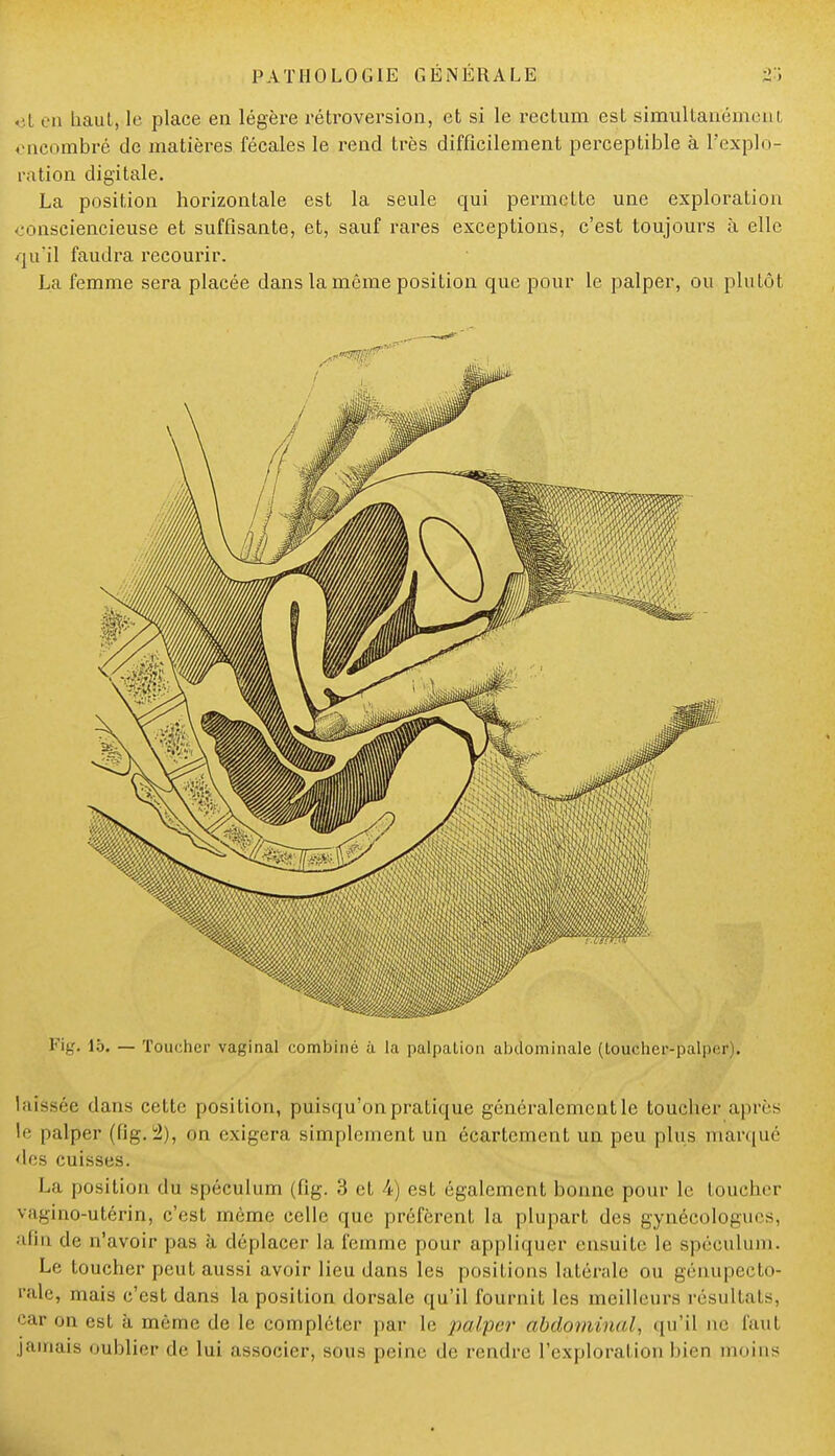 et en haut, le place en légère rétroversion, et si le rectum est simultanément encombré de matières fécales le rend très difficilement perceptible à l'explo- ration digitale. La position horizontale est la seule cpii permette une exploration consciencieuse et suffisante, et, sauf rares exceptions, c'est toujours à elle qu'il faudra recourir. La femme sera placée dans la même position que pour le palper, ou plutôt Fig. 15. — Toucher vaginal combiné à la palpation abdominale (toucher-palper). laissée dans cette position, puisqu'on pratique généralement le toucher après le palper (fig.2), on exigera simplement un écartement un peu plus marqué des cuisses. La position du spéculum (fig. 3 et 4) est également bonne pour le toucher \ a ^-i no-utérin, c'est même celle que préfèrent la plupart des gynécologues, afin de n'avoir pas à déplacer la femme pour appliquer ensuite le spéculum. Le toucher peut aussi avoir lieu dans les positions latérale ou génupecto- rale, mais c'est dans la position dorsale qu'il fournit les meilleurs résultats, car on est à même de le compléter par le palper abdominal, qu'il ne fini jamais oublierde lui associer, sous peine île rendre l'exploration bien moins